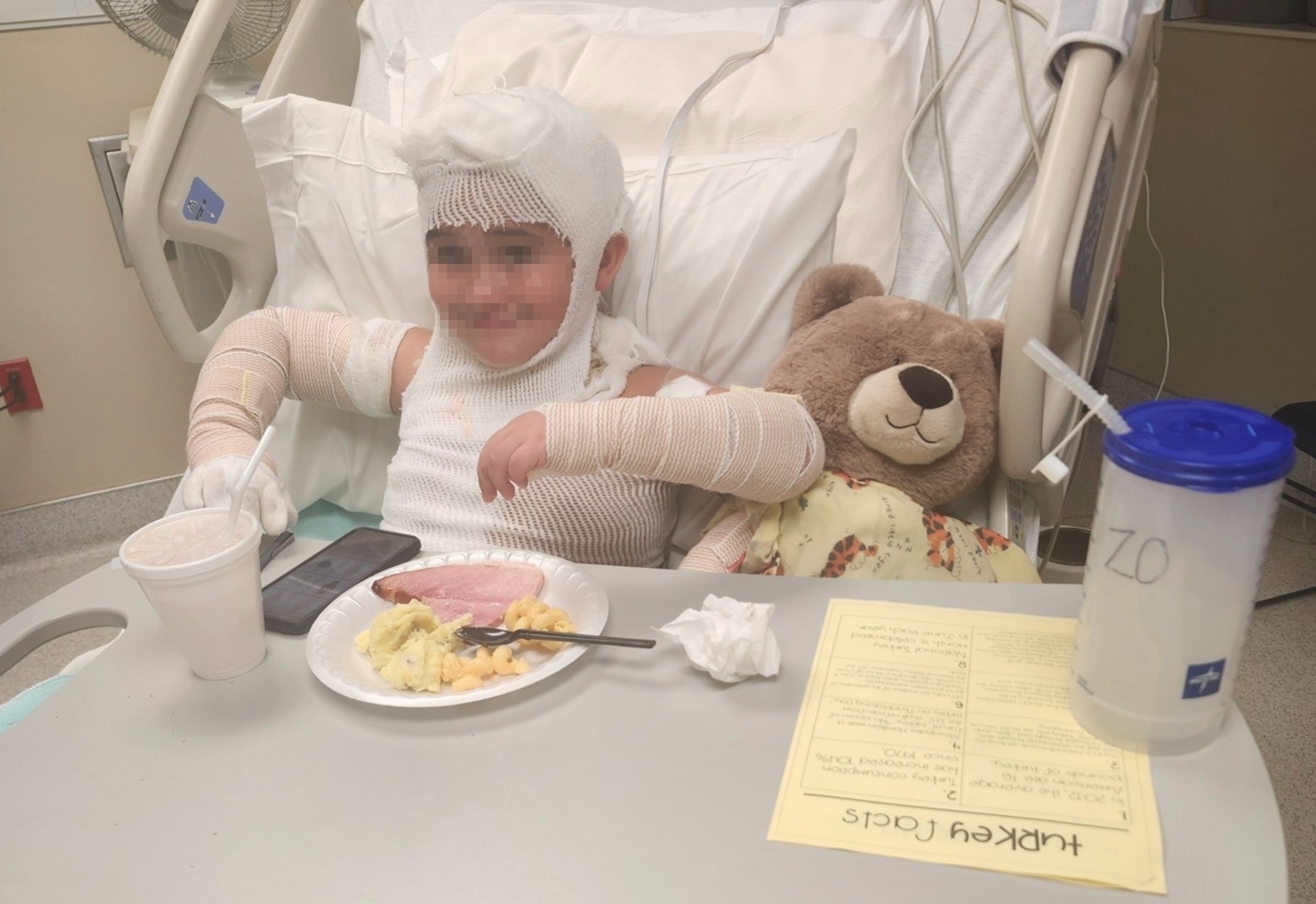 項鍊卡進充電線與插頭間隙引發火花，8歲男童脖子遭嚴重燒傷，仍在醫院接受治療。（翻攝自gofundme）
