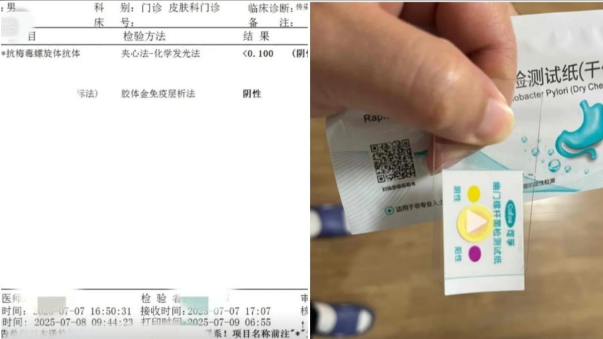 熾陽的檢驗結果由陰(左)轉陽(右)。(翻攝自抖音@炽阳angel