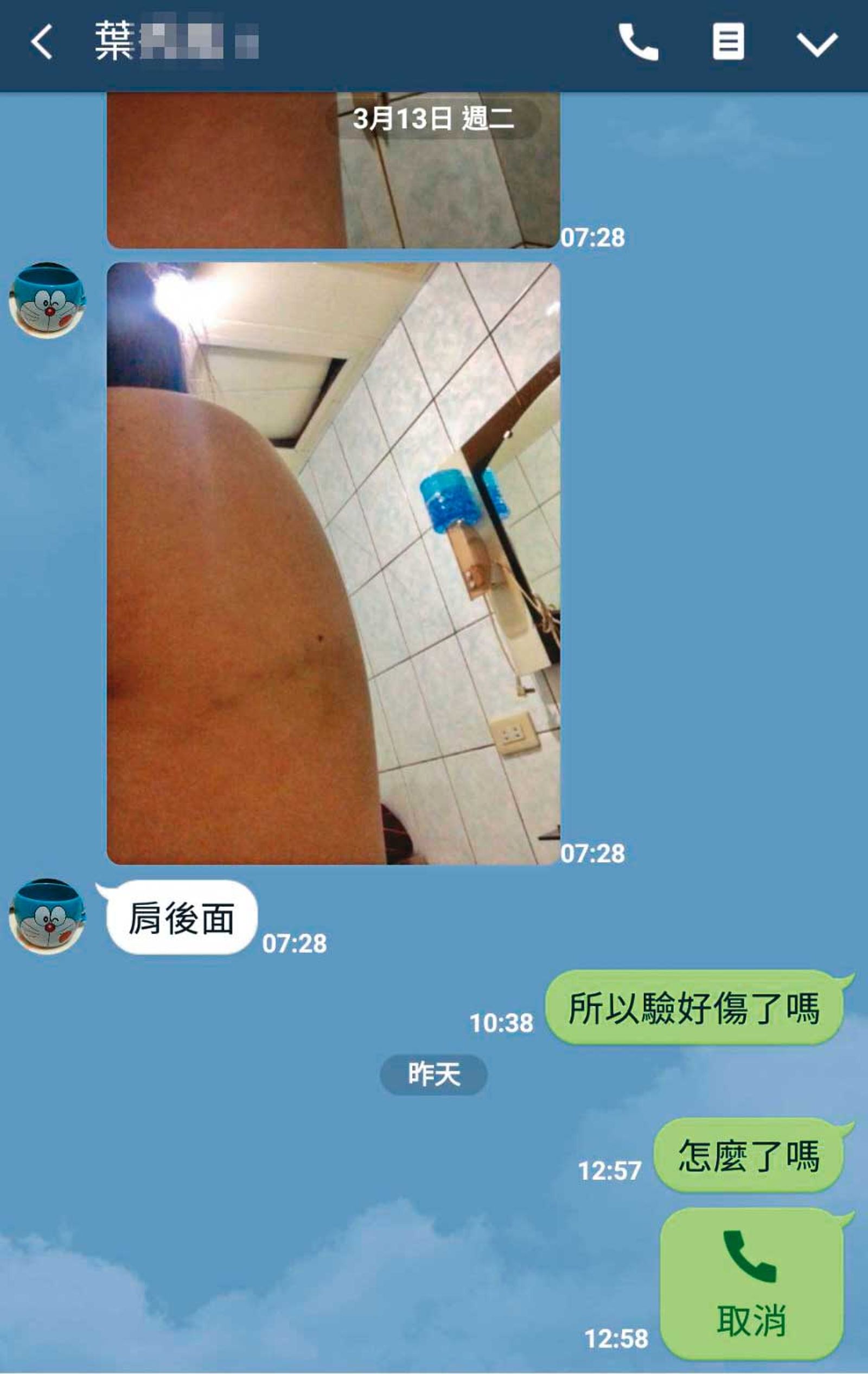 死者肩膀曾被大嫂打傷，她因此準備驗傷提告。（翻攝畫面）