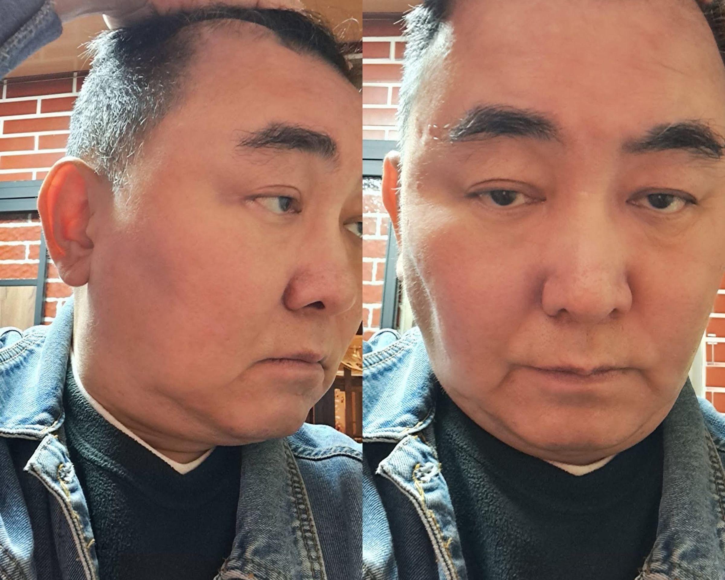 徐亨早年因創業欠下鉅額債務，自揭腦水腫治療導致月亮臉。（翻攝徐亨臉書）