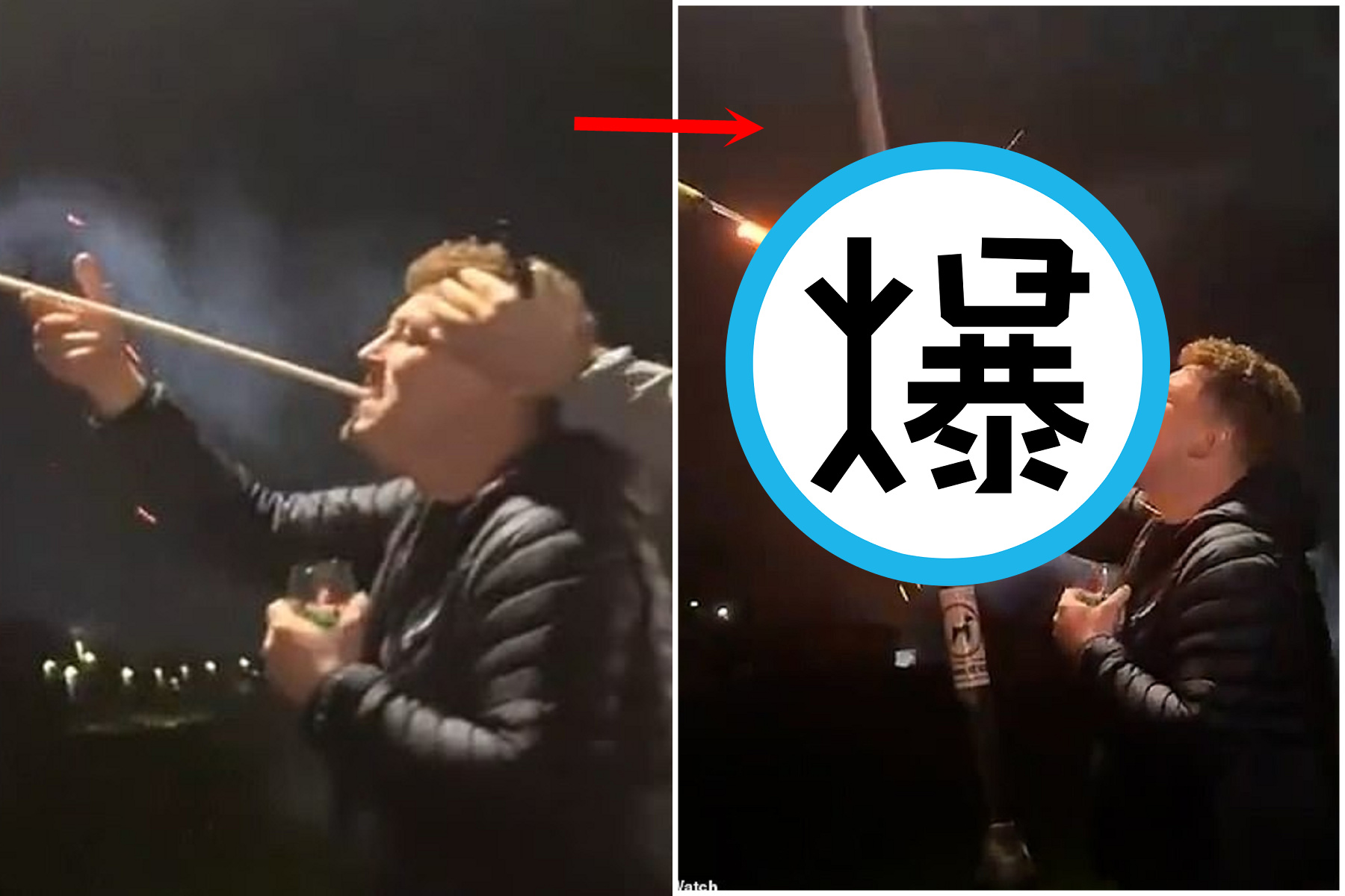 男「打嘴砲」下場超恐怖！煙火後勁太強，他慘被鞭炮射顏炸臉。（翻自《每日郵報》）