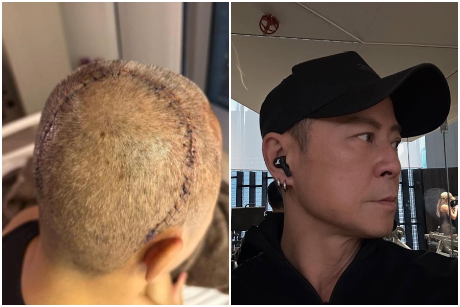 現年59歲的香港樂團草蜢成員蔡一傑,前年10月因罹患惡性腫瘤接受開腦手術,目前仍積極抗癌。(翻攝自蔡一傑臉書)