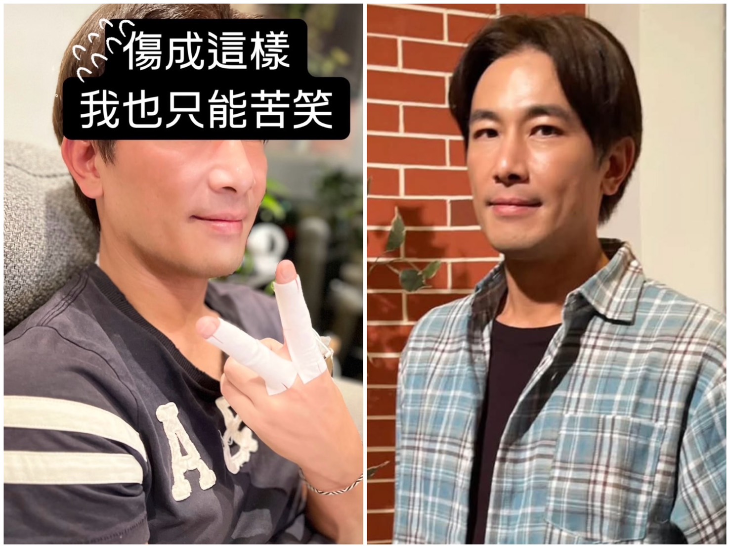 傅子純日前PO出兩根手指都受傷剛好比成YA。（翻攝臉書）