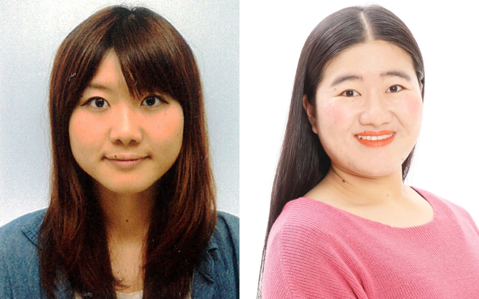 淑子近日公開自己罹患腦部罕見疾病「下垂體腺瘤」的經歷,鼻子明顯變大了。(翻攝自yoshimoto.official IG)