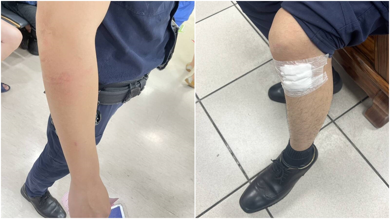 新北市永和警分局上午攔查1名疑似毒駕的男子時,對方竟藉故落跑踩油門衝撞2名員警後逃逸,目前警方正全力追緝,最終毒品呈現依托咪酯陽性反應。(翻攝畫面)