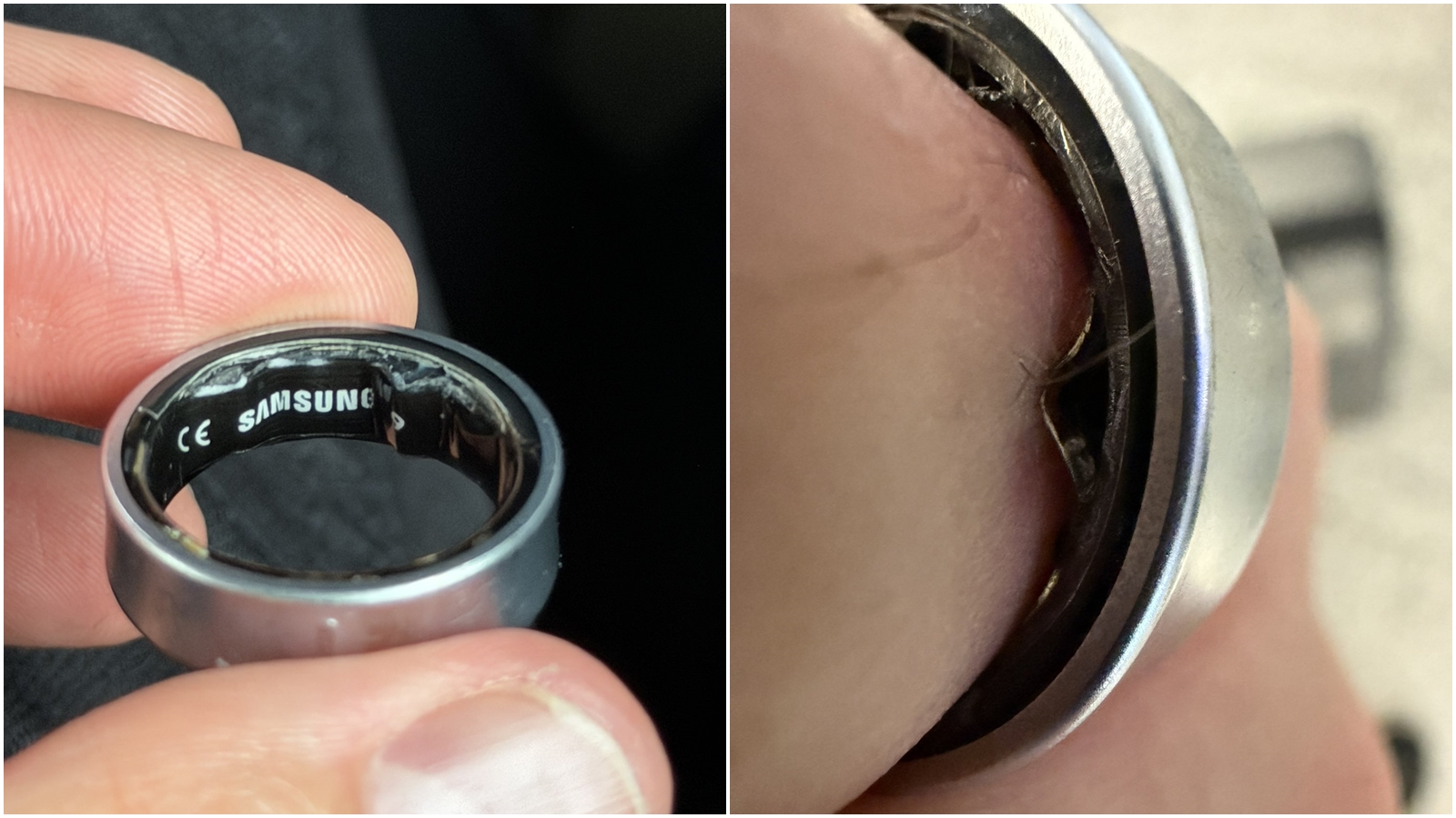 英國科技網紅洛塔，因為配戴的三星智慧戒指電池膨脹，導致戒指卡在他的手指上。（翻攝自X@ZONEofTECH）