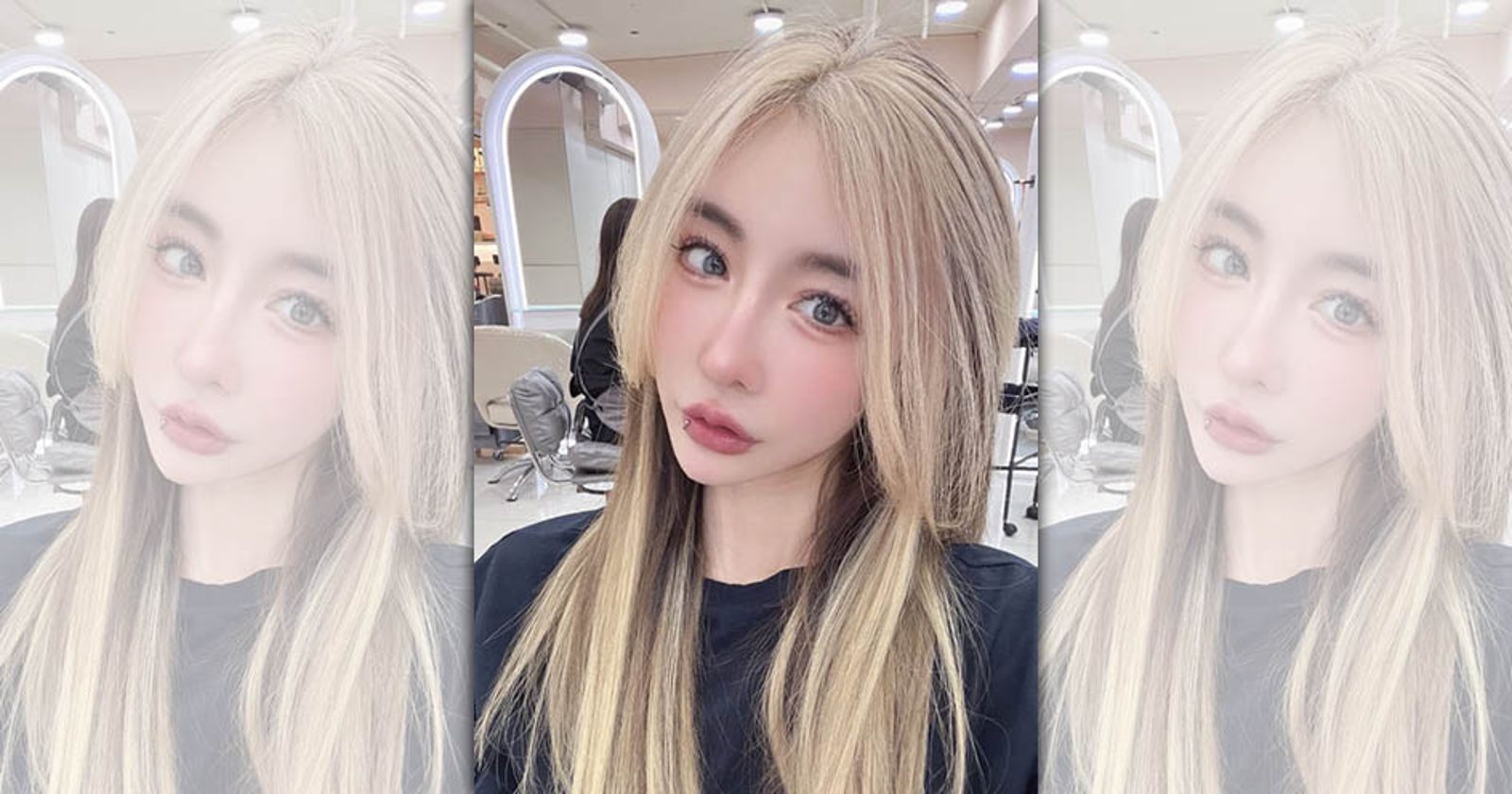 花千萬整形臉部！雪碧因提眼肌太高的後遺症　眼睛像被針插