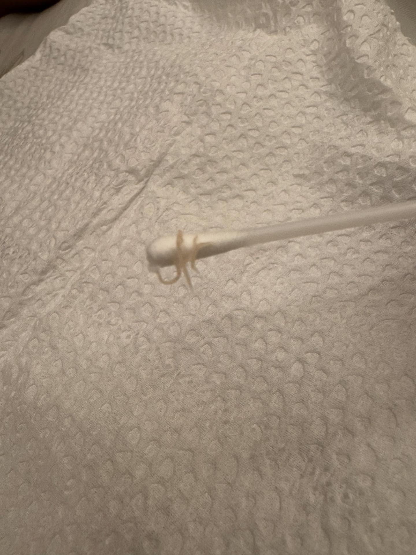 一名媽媽因為孩子喊屁股癢,卻在擦藥時在孩子的屁股掏出蠕動的蟯蟲。(翻攝threads@minitifa)