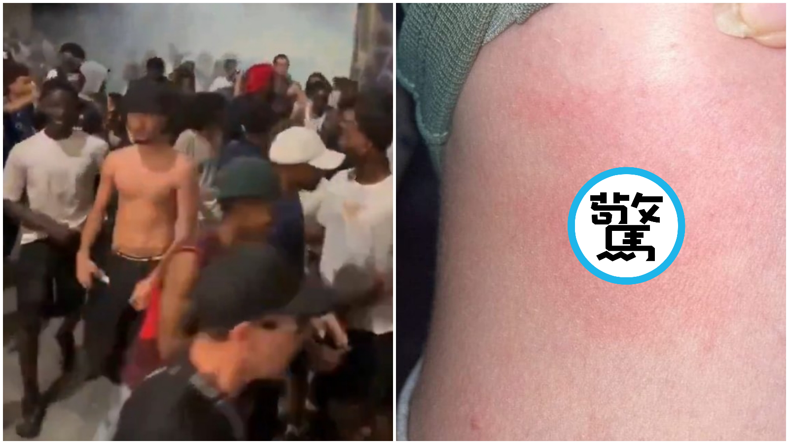 法國街頭音樂節衝突頻傳，多達145人遭針頭刺傷。（翻攝X）