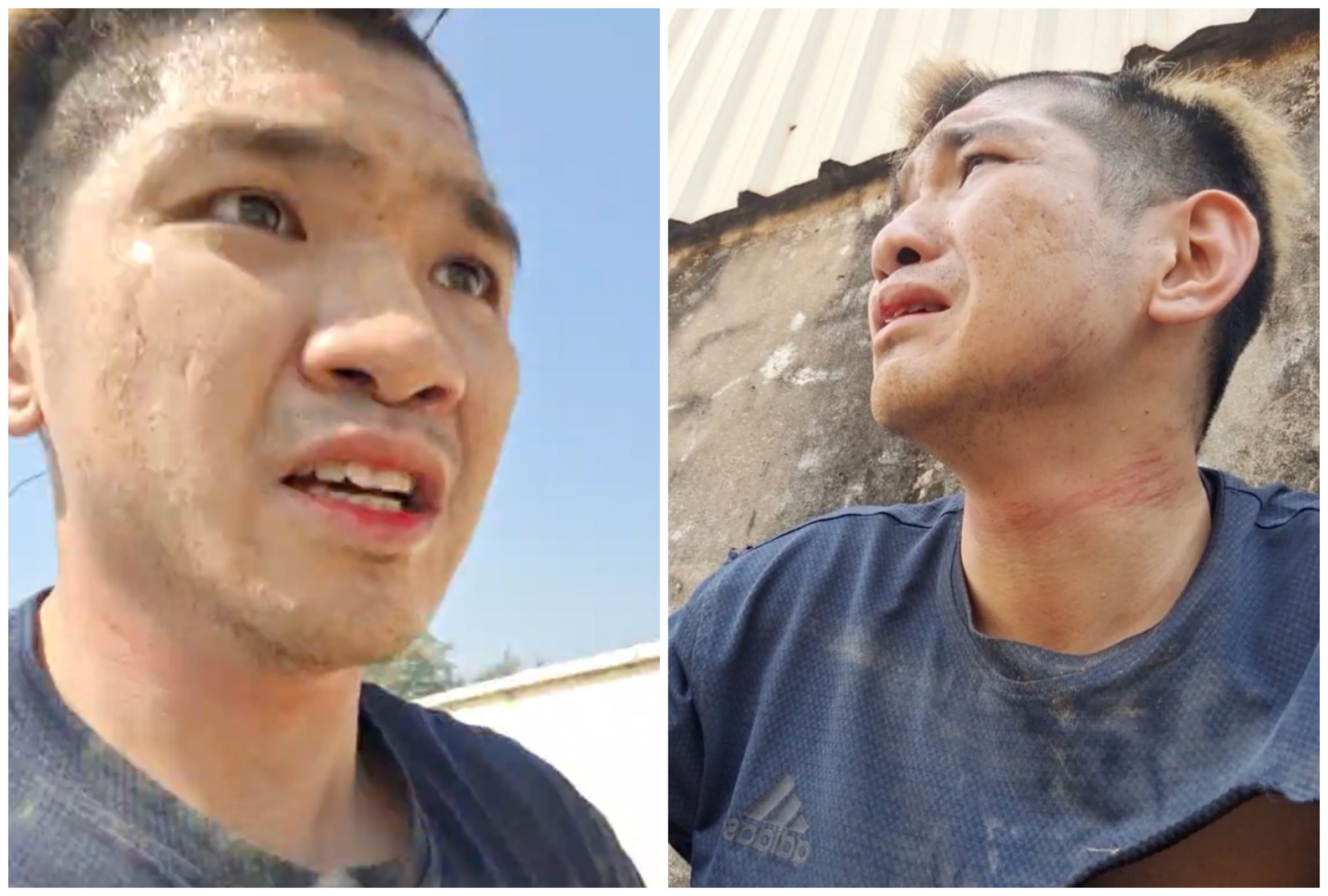 晚安小雞今下午開直播,提到自己被人放走後趕快逃出,可見他臉上、脖子及手臂都有明顯傷痕。(翻攝自晚安小雞臉書)