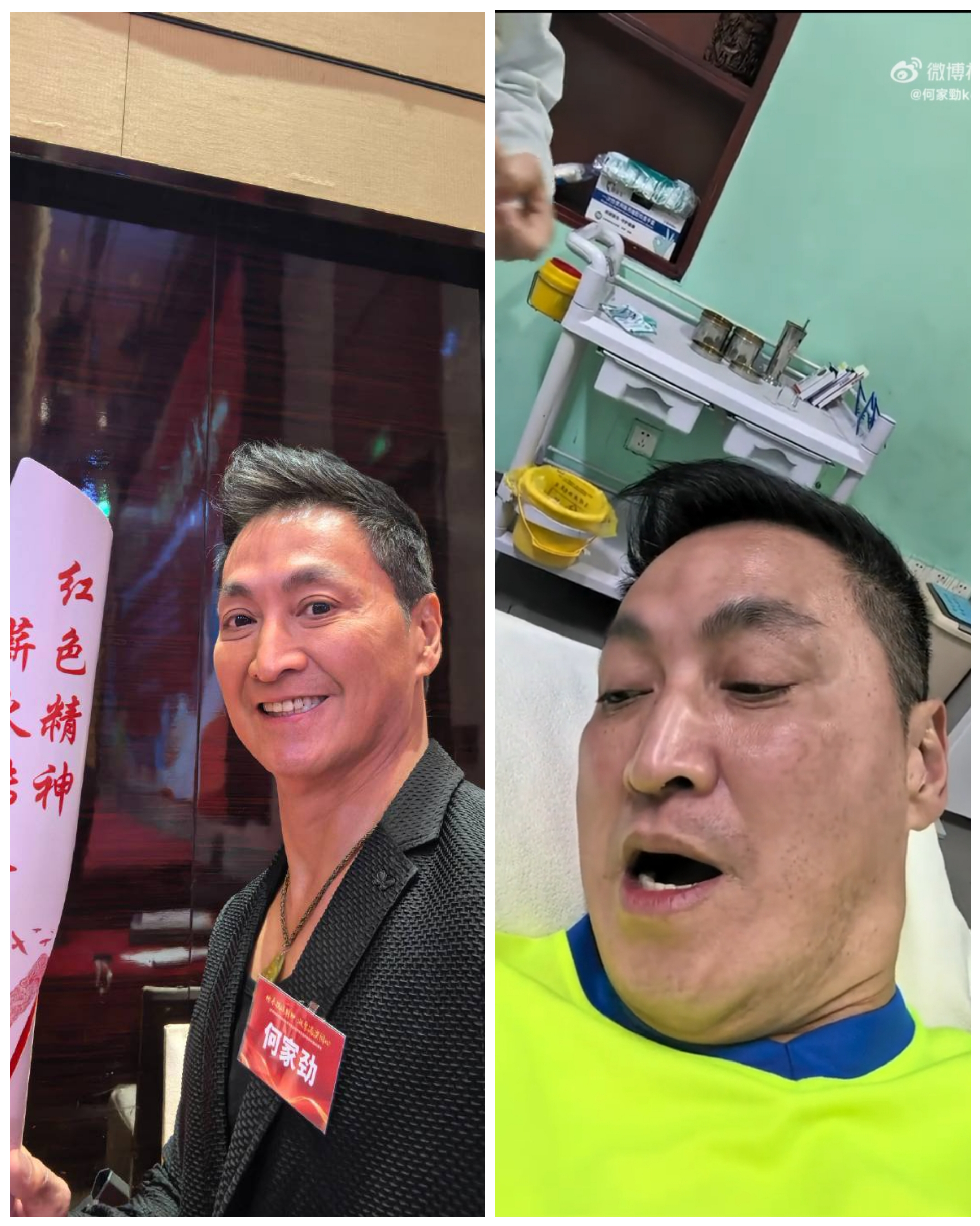 何家勁雖已65歲,但體能狀態保持得相當好,演慣大俠的他,在扎針治療時也不近痛到臉色大變。(何家勁微博)