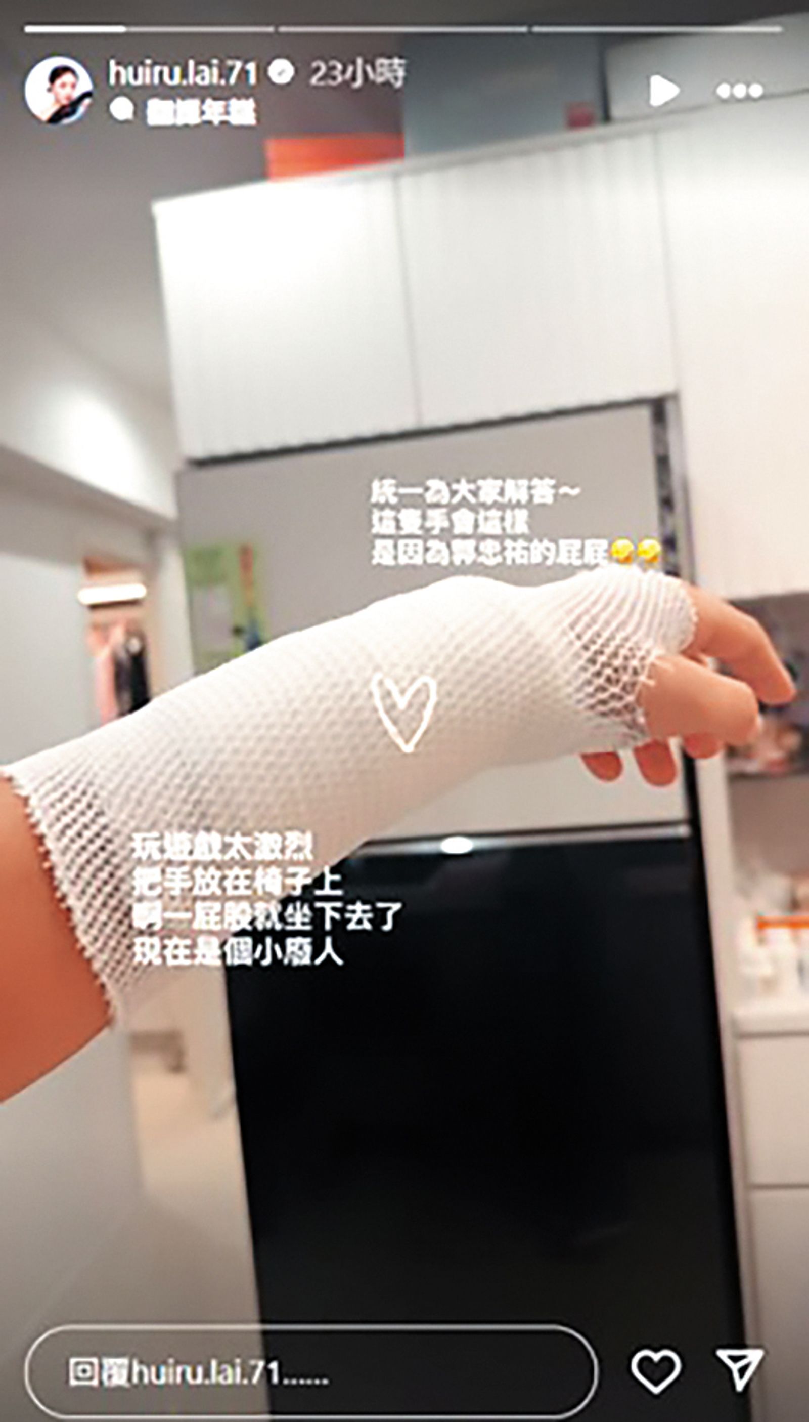 賴慧如流年不利，日前因上節目玩遊戲，被郭忠祐一屁股坐下壓傷手。（翻攝自賴慧如IG）