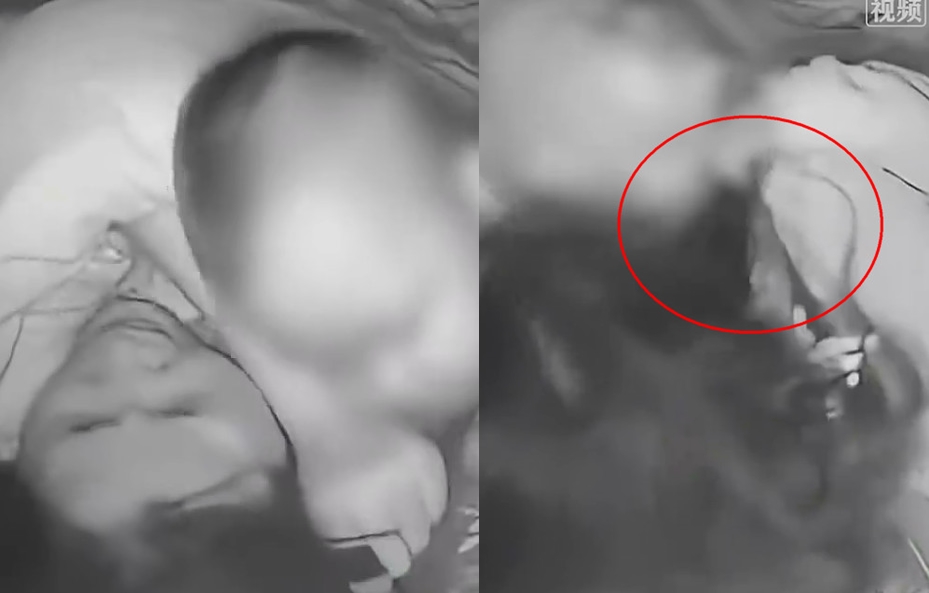一名男嬰睡夢中被母親的長髮纏繞脖子險些窒息，幸好母親及時扯斷髮才救回一命。（翻攝微博）
