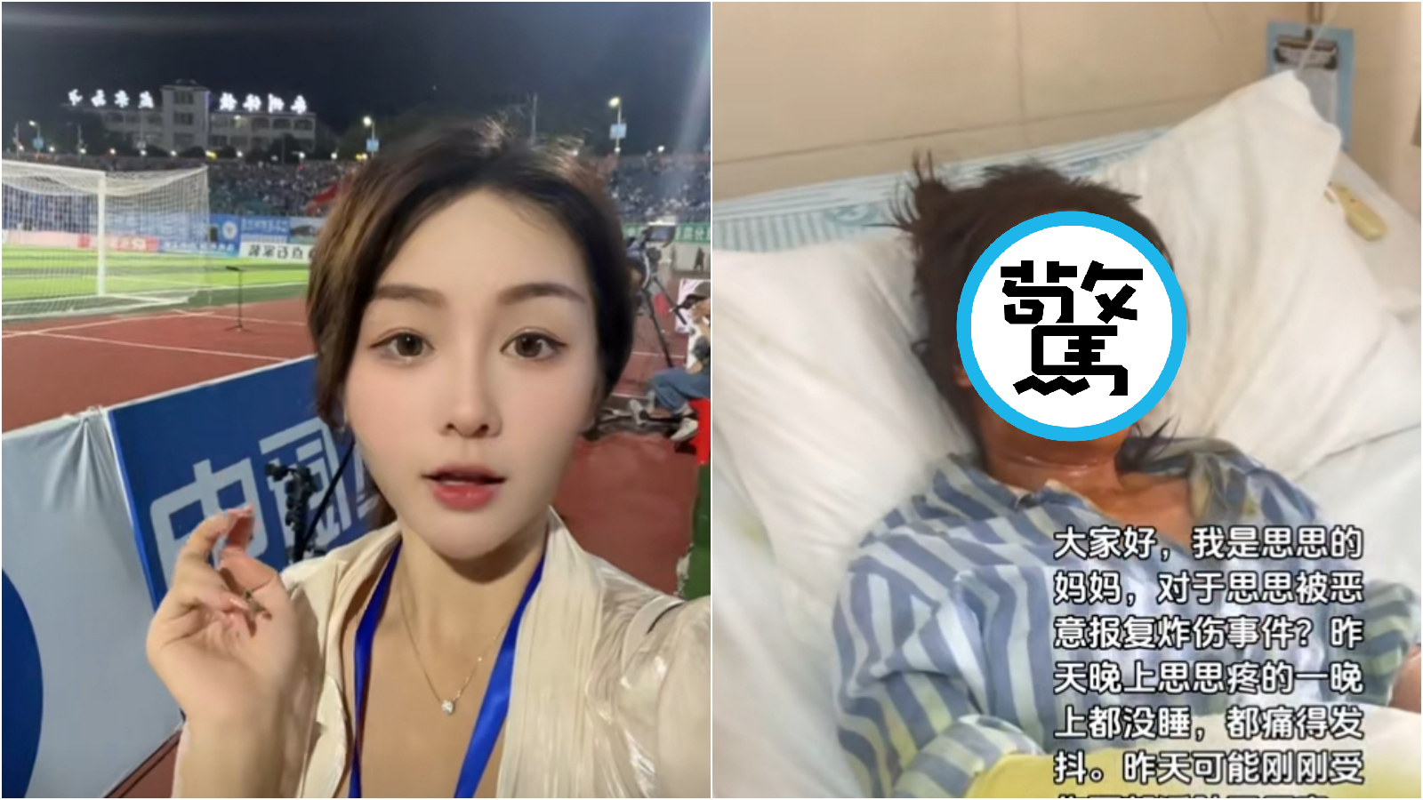 中國正妹主播收到「炸彈包裹」遭炸傷毀容。(翻攝抖音@Shushuy918)