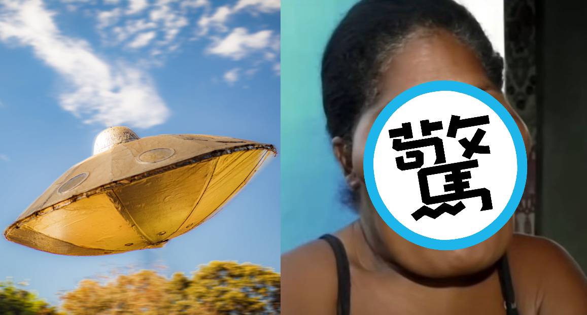 一家人有5位兄弟姊妹換了罕見的疾病，讓他們的長相酷似外星人。（翻攝Jam Press）