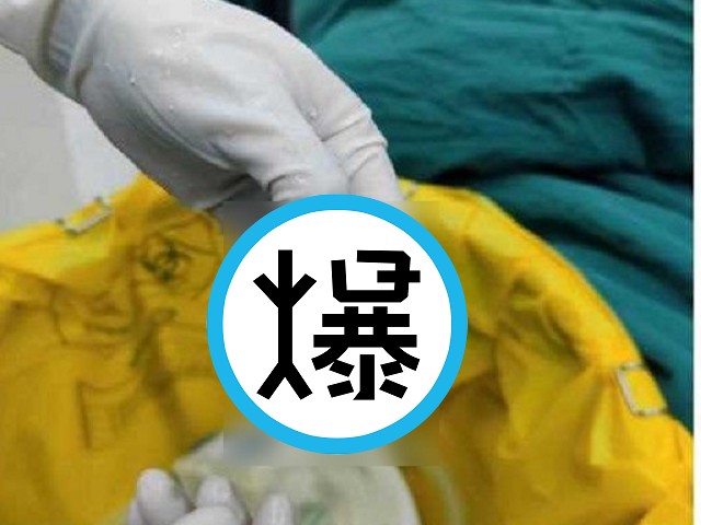 妹子分手「用口交流」咬斷男友生殖器！醫師妙手回春接回去，結局太勁爆。（翻自微博）