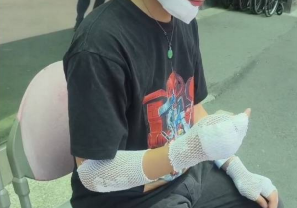 彰化4天2起!男遭流浪狗「瘋狂追咬」慘摔全身傷 無奈嘆「常有人開車來餵養」