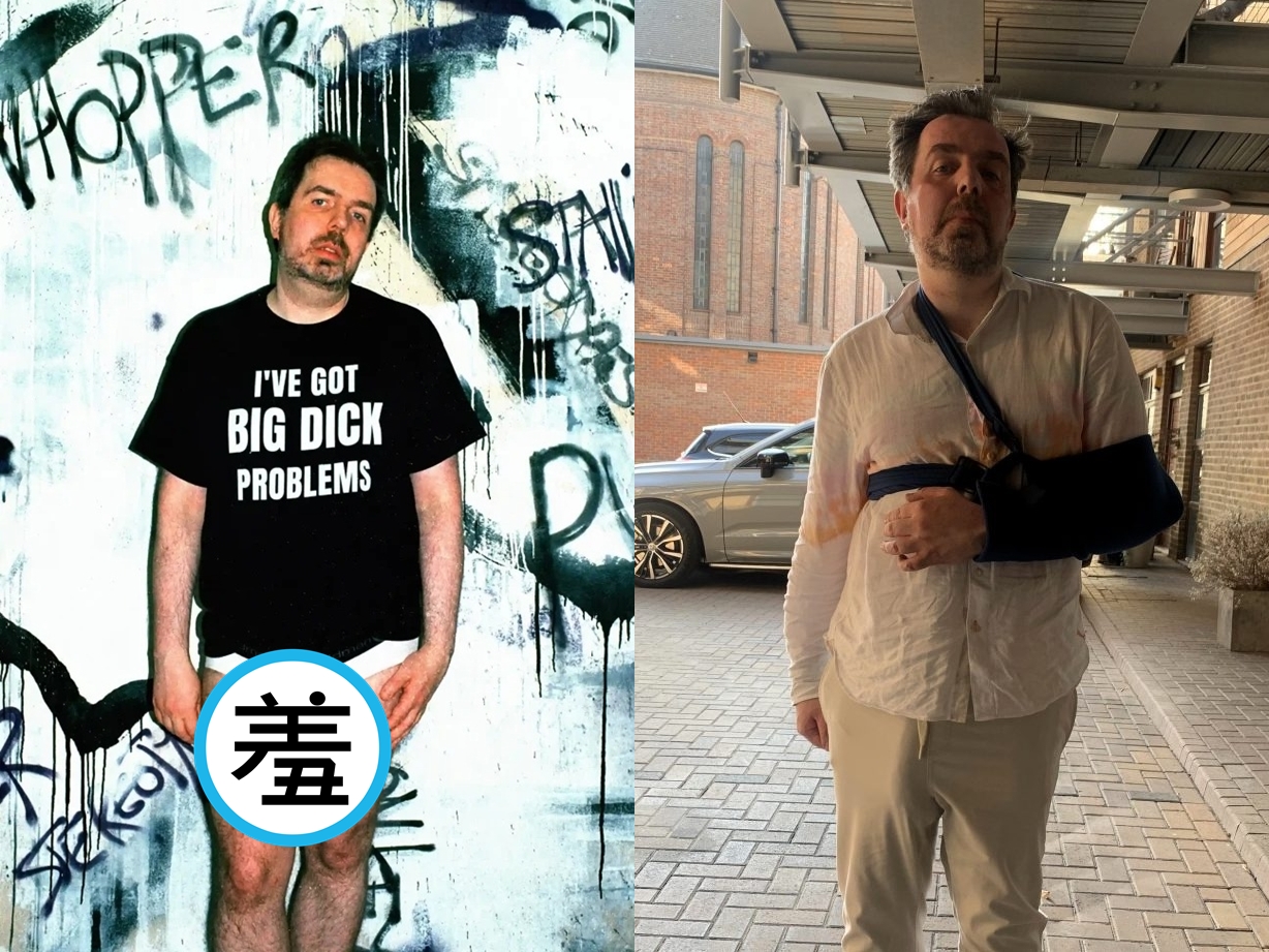 英國41歲男子馬特因擁有經醫學認證、長達37公分的「世界最大陰莖」而多次成為媒體焦點。（翻攝自needtoknow）