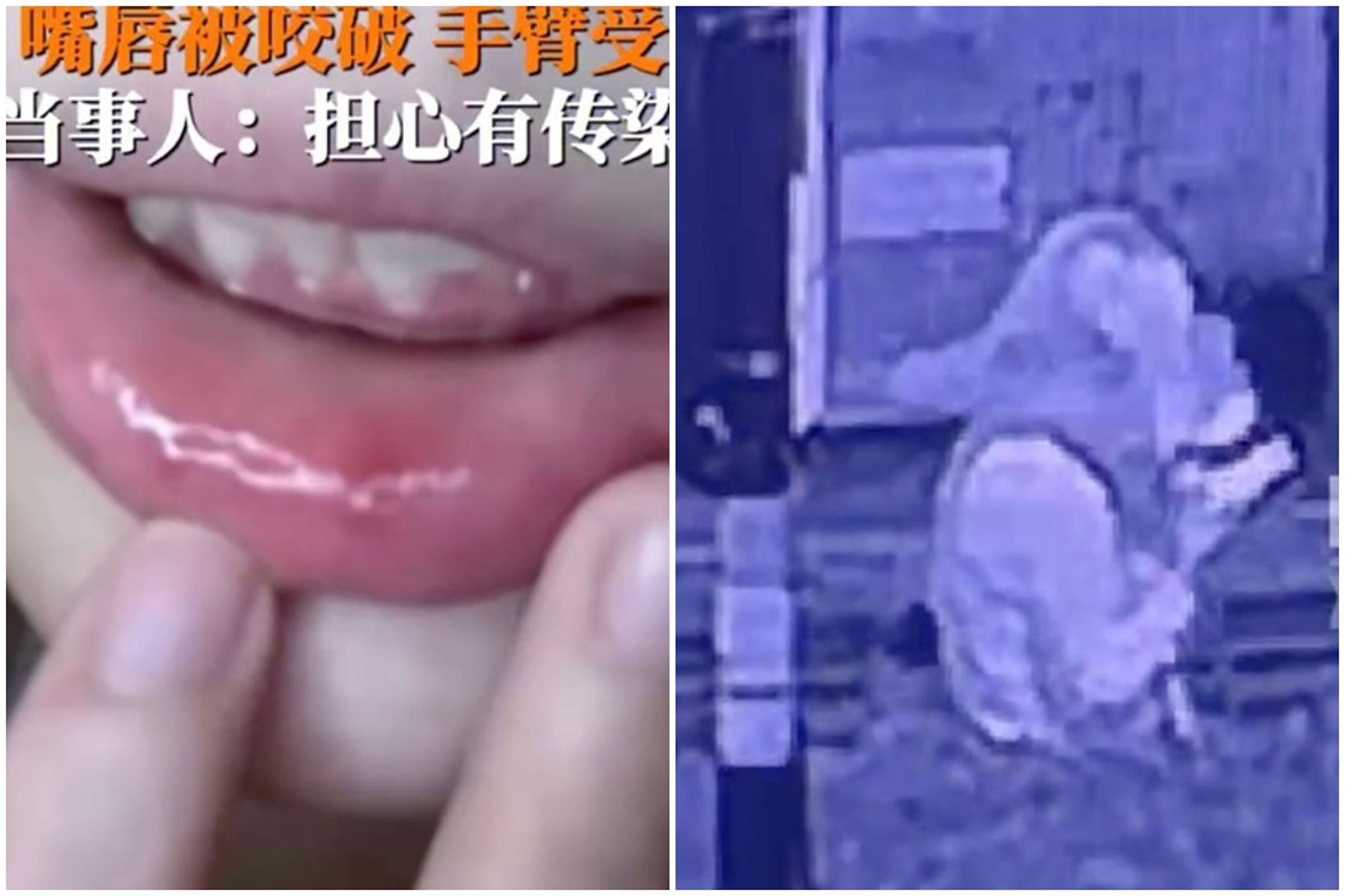 中國杭州一名年輕女子13日晚間在住家附近路邊滑手機，被一名陌生男子強吻。（翻攝自微博）