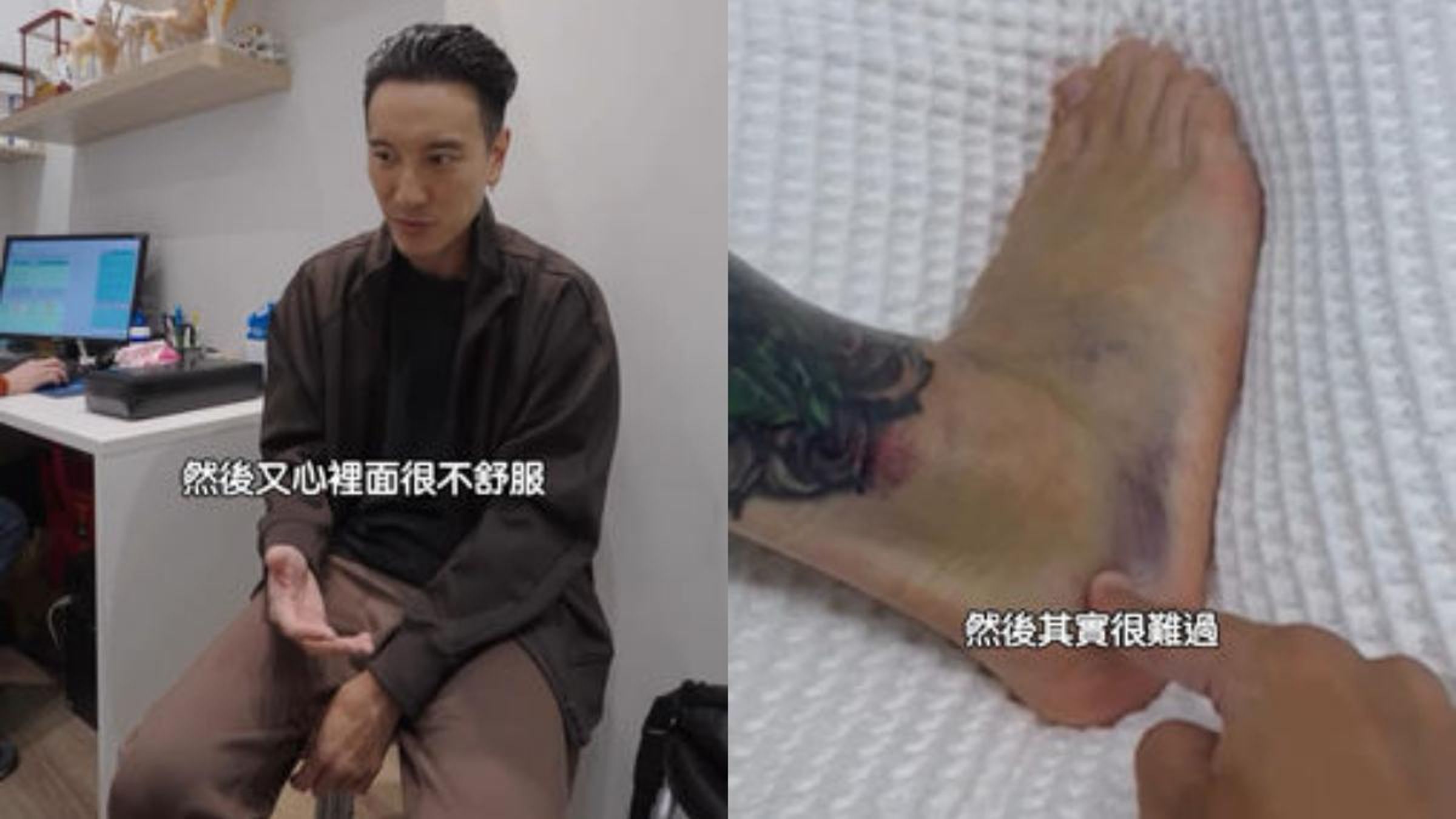 王陽明打籃球時不慎扭傷，韌帶撕裂、兩處骨裂。（翻攝自王陽明IG）