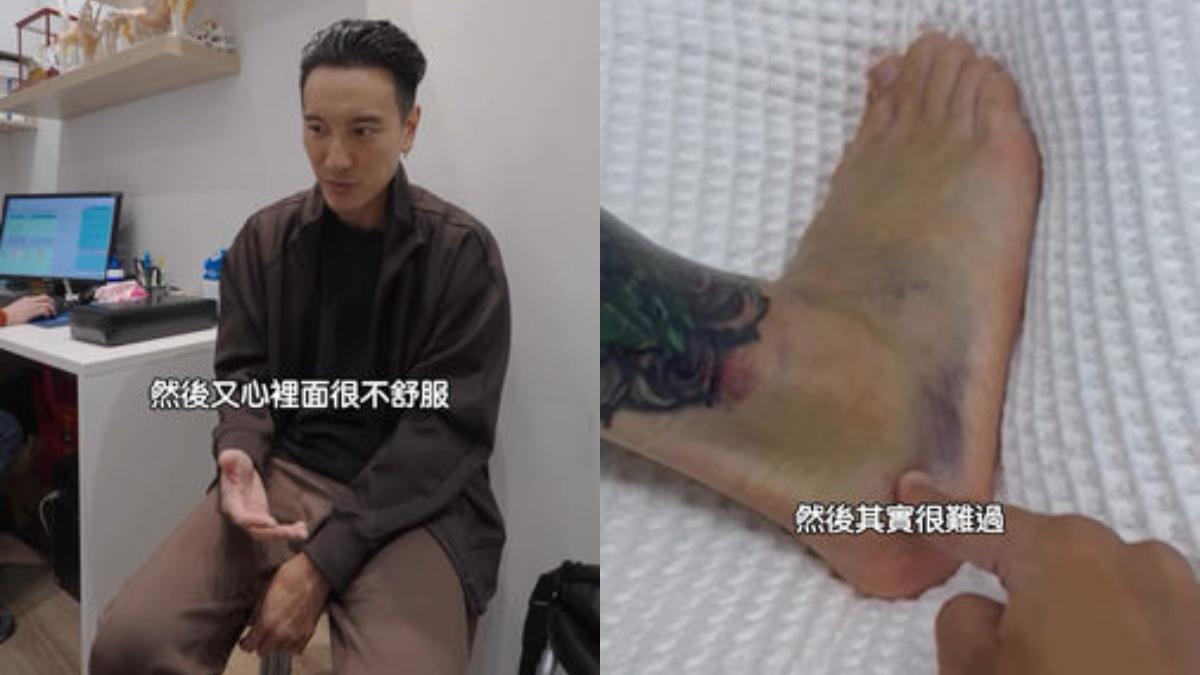 王陽明打籃球時不慎扭傷，韌帶撕裂、兩處骨裂。（翻攝自王陽明IG）
