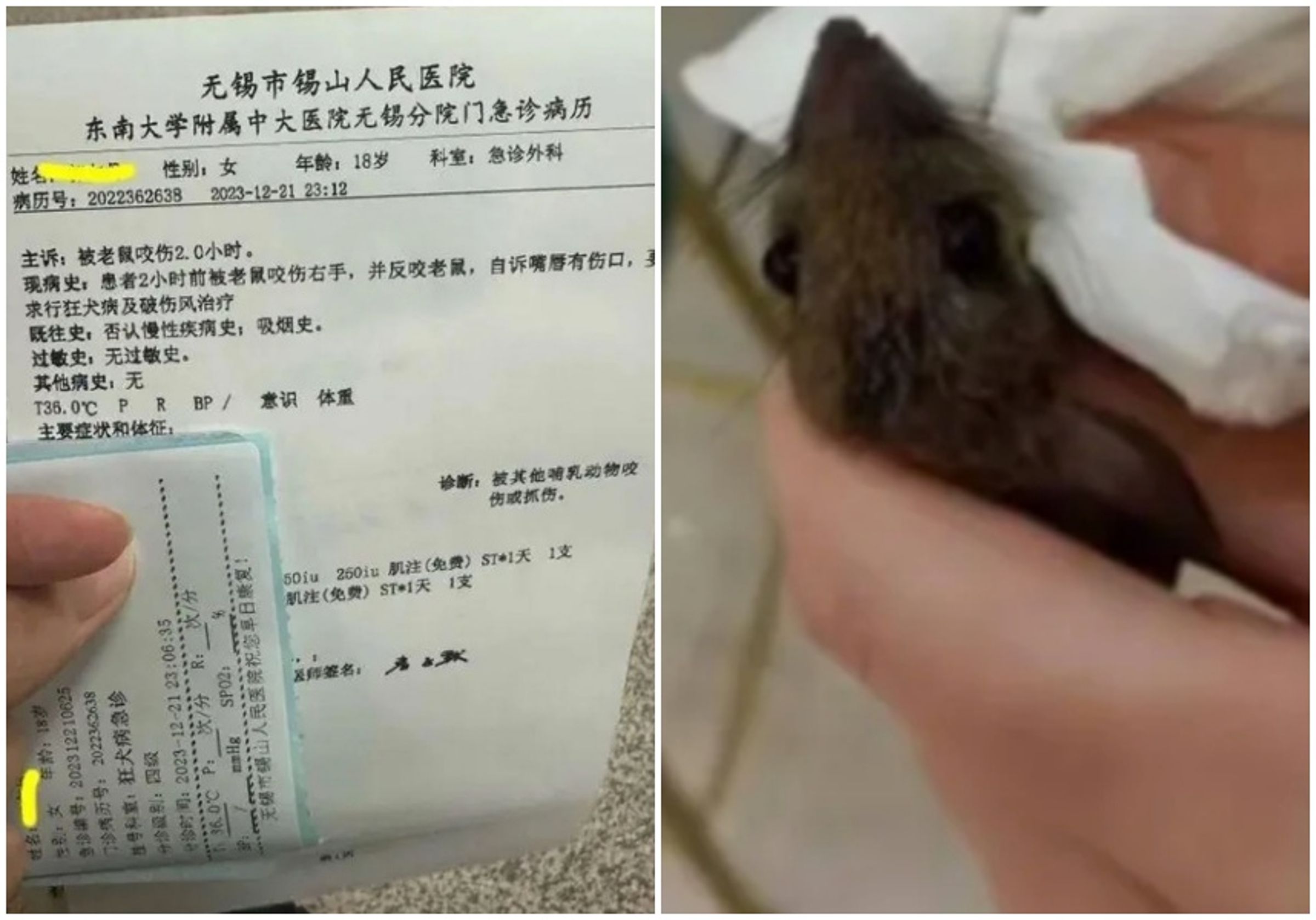 根據上圖左,女子自述咬了老鼠後嘴巴出現傷口,因此要求醫院打針治療。(翻攝自微博)