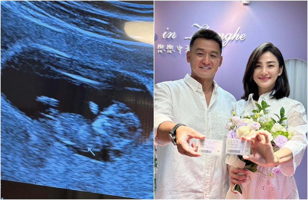 洪小鈴分享寶寶超音波照。（翻攝IG、臉書）