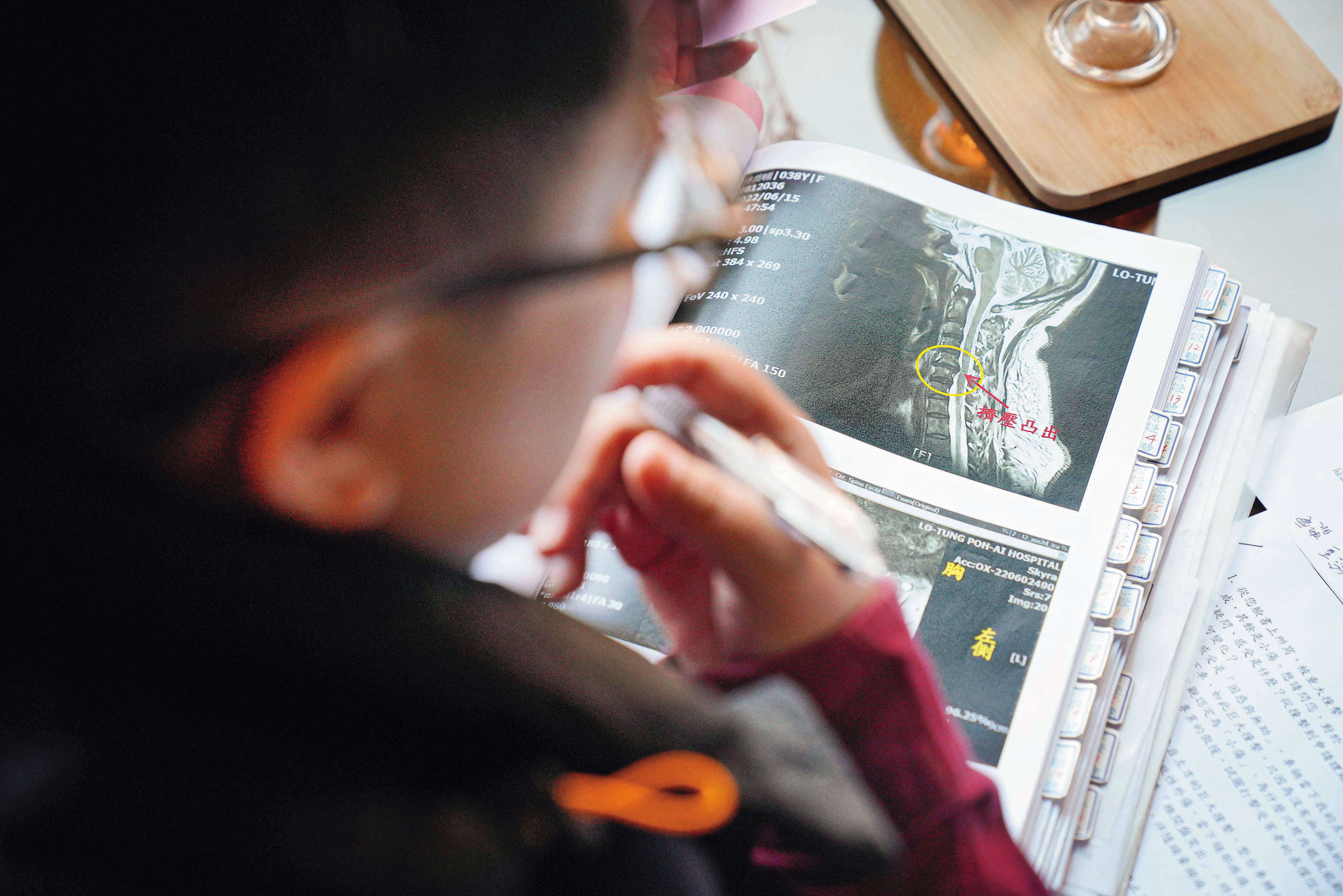 Mapee因車禍造成頸椎椎間盤突出，歷時3年奔波，才終於獲得48萬元理賠。