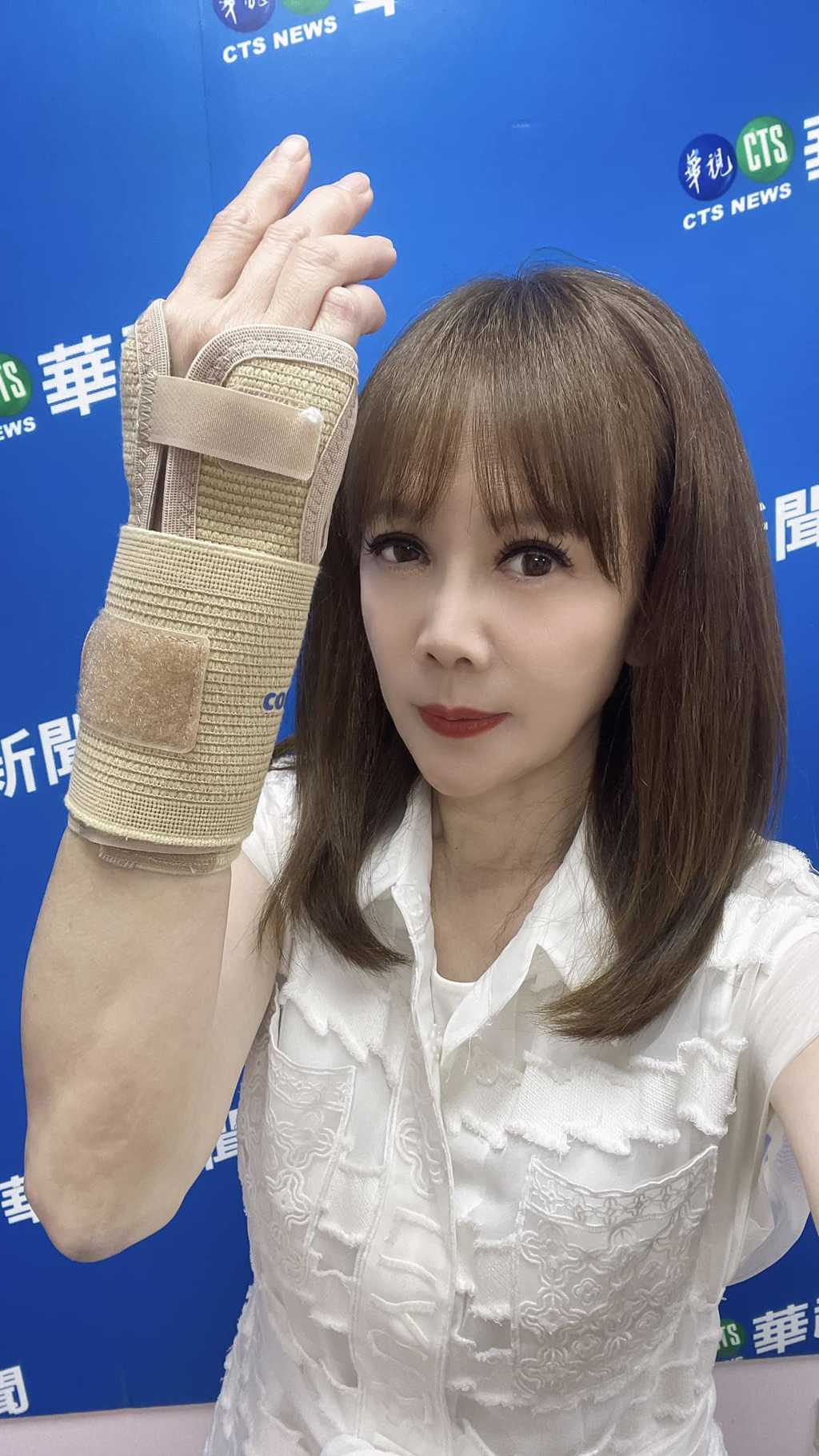 陳雅琳右手骨折,需要3個月時間復原。(翻攝自陳雅琳臉書)