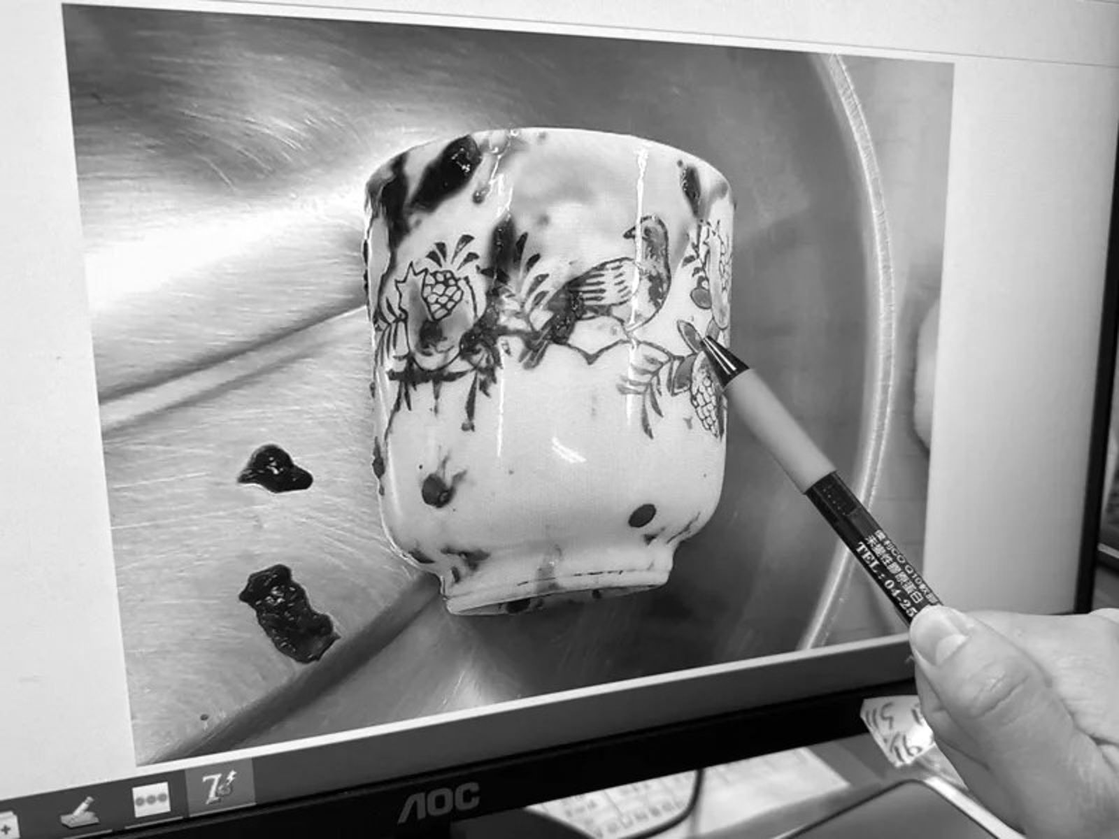 挑戰人體極限！男腹痛3天無法排便　照X光驚見肛門塞6CM陶瓷杯