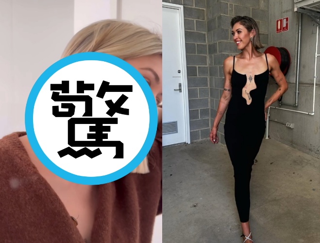 「這太像恐怖片！」正妹網紅脖子勒傷嚇壞粉絲。（翻攝自instagram @eli__moulton）