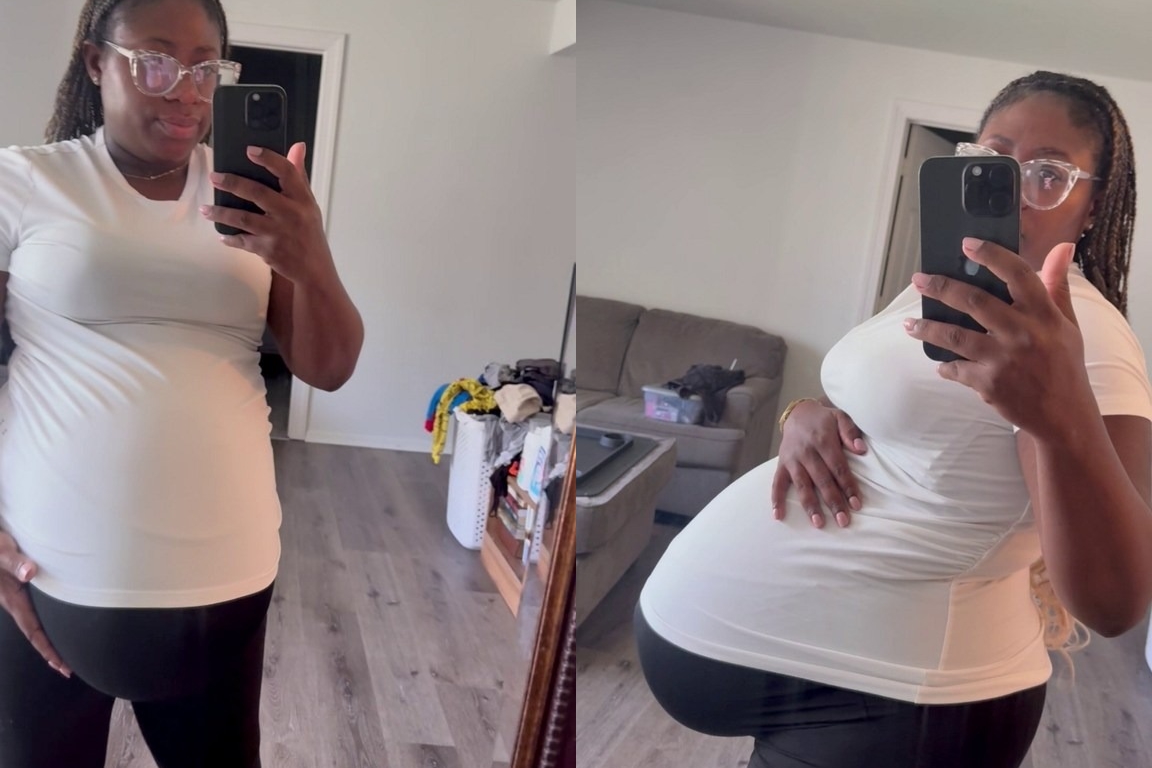 1名32歲孕婦艾希莉孕肚過大，生產前1天突然出現子宮破裂。（翻攝畫面）