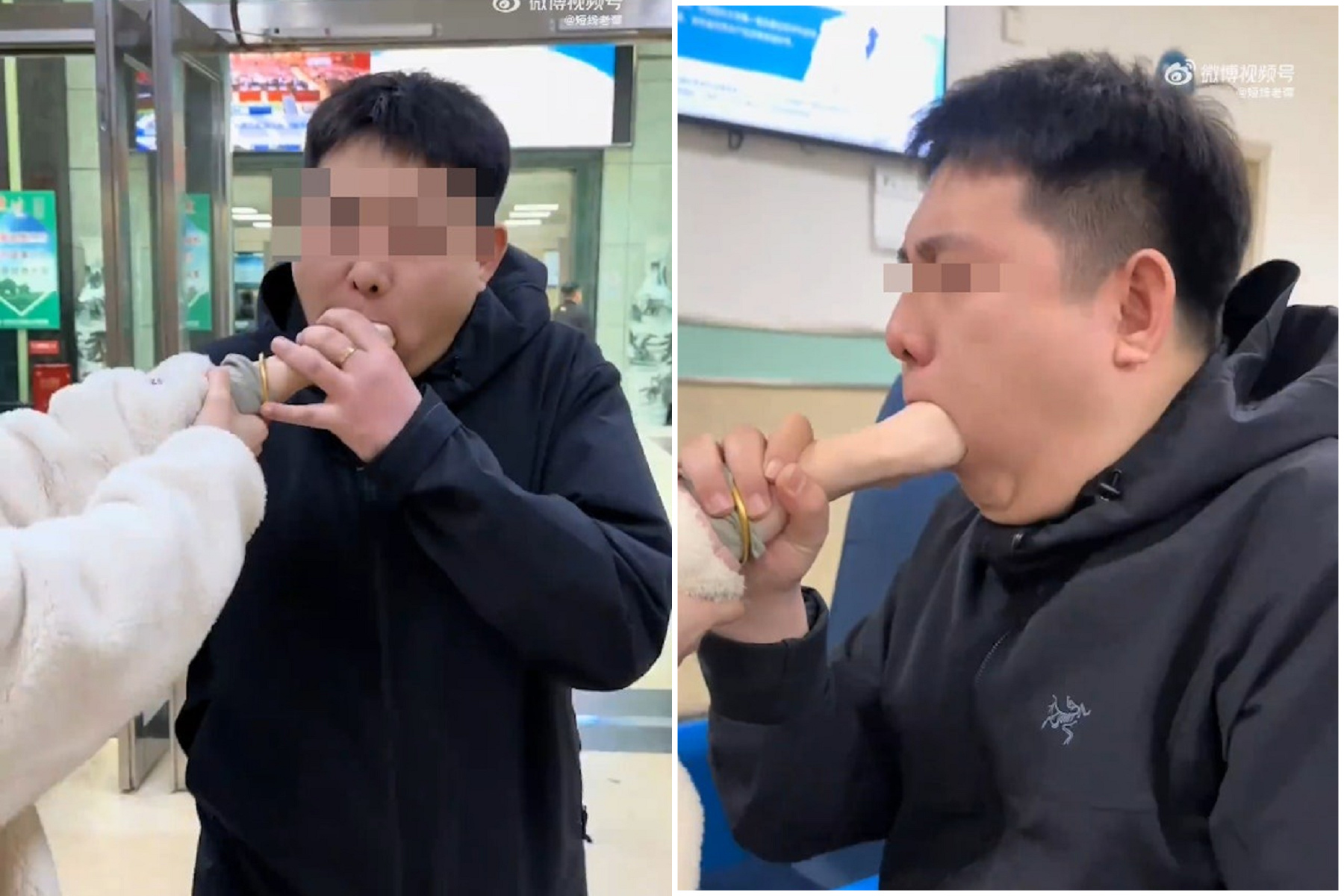 超越口含！男吃女友手手拔不出來，兩人「超連結」進醫院。（翻自微博）