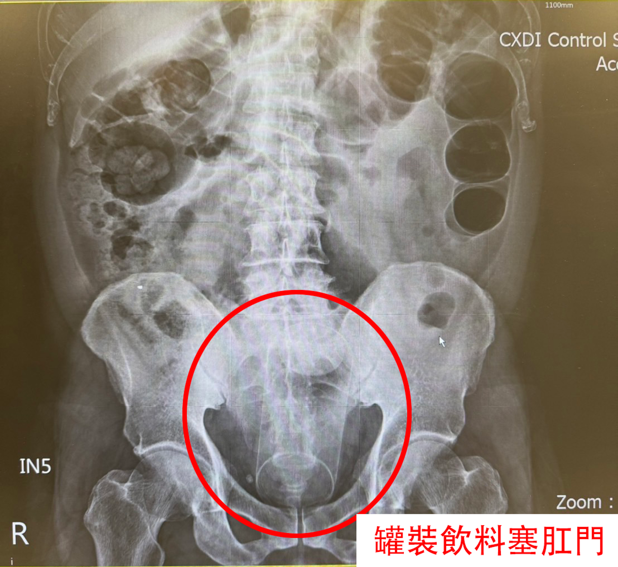 邵彥誠主任呼籲民眾勿從事危險行為。（中國醫藥大學新竹附設醫院提供）