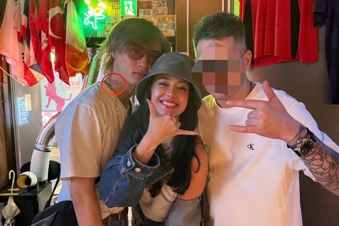 澤尻英龍華與脖上吻痕的橋本良亮、友人曾親暱合照。(翻攝網路)