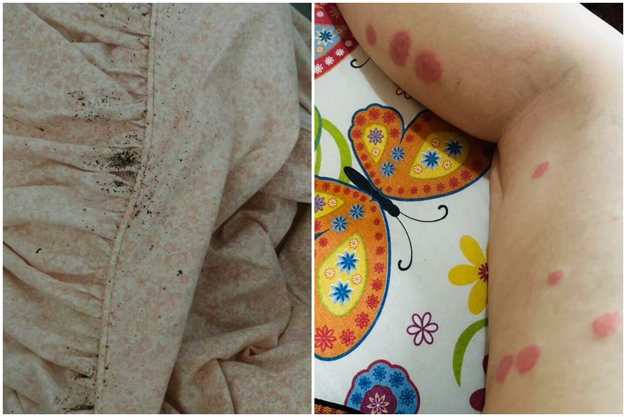 旅遊達人布萊N呼籲到南韓旅遊的國人慎選飯店，避免把蟲蟲危機帶回台灣。（翻攝自皮膚科蔡逸姍醫師、布萊N 機票達人臉書）