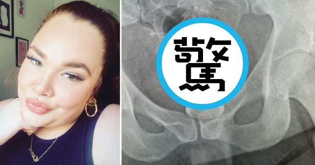 女玩性玩具頂到深處卡體內，俊男醫師「龍爪手急救」讓她再刺激一次。（翻自《都市報》）