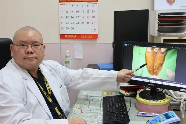 隨著暑假到來,泌尿科醫師特別提醒年輕族群必須注意安全性行為。(李綜合醫院提供)