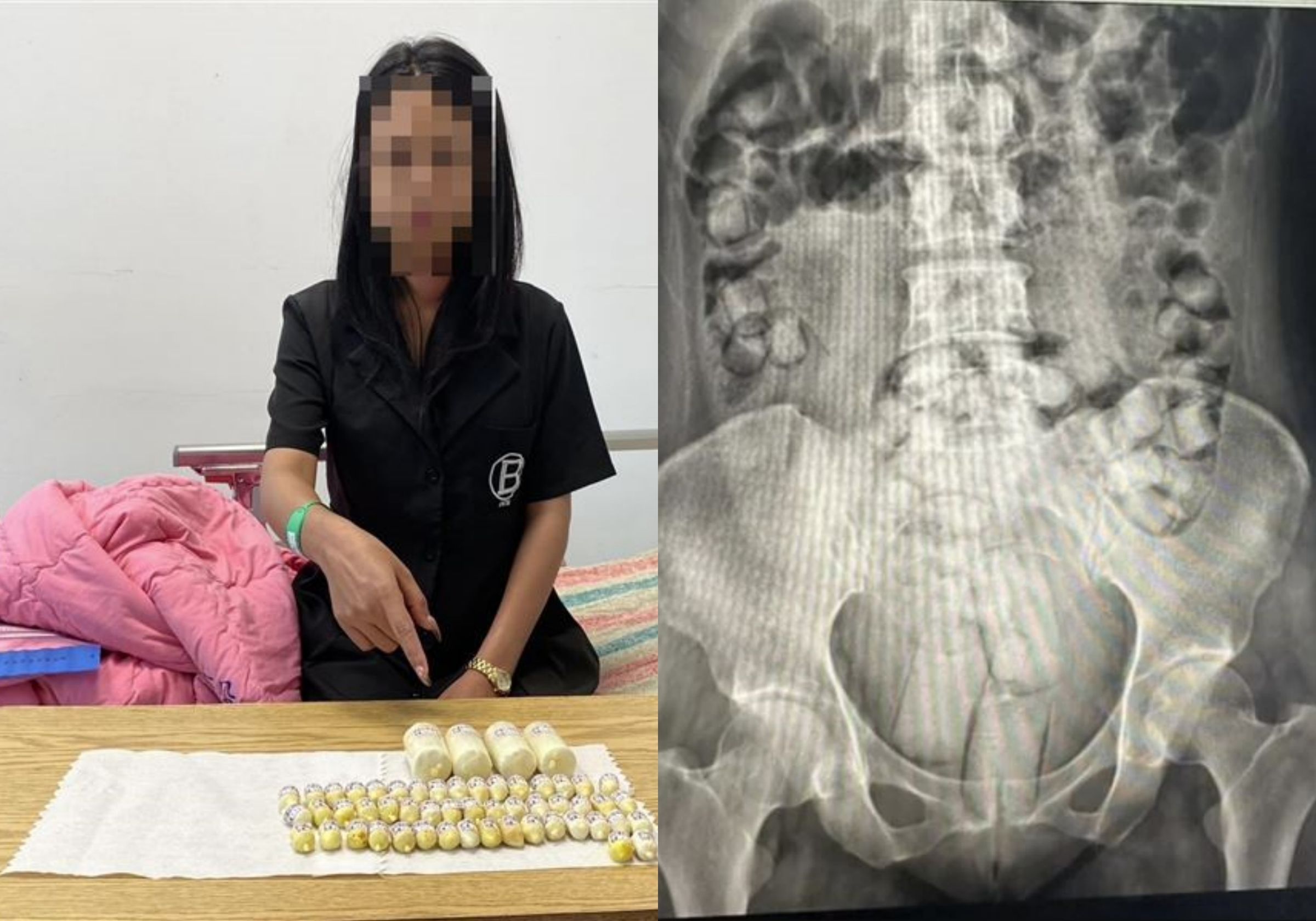 2名泰國女子企圖人體運送海洛因來台,遭逮個正著。(翻攝畫面)