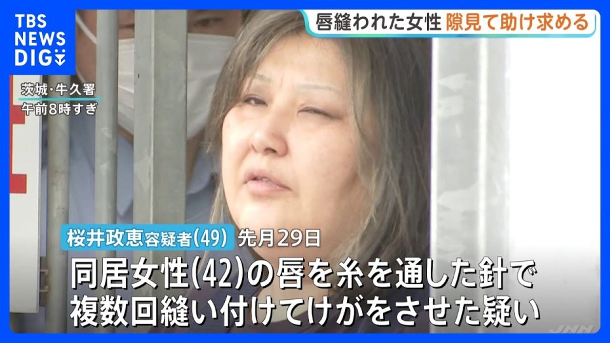 49歲嫌犯櫻井政惠涉嫌持針線將同居女子的上下嘴唇縫合，導致對方無法開口說話。（翻攝自TBS）