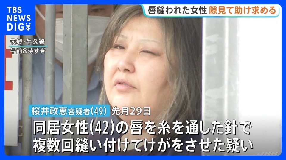 49歲嫌犯櫻井政惠涉嫌持針線將同居女子的上下嘴唇縫合,導致對方無法開口說話。(翻攝自TBS)