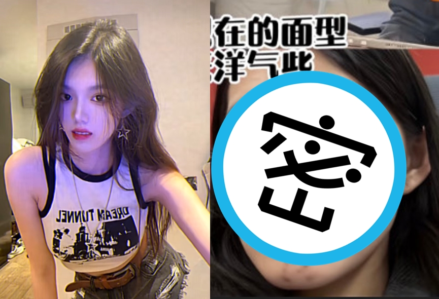 小雨本來只是要去補牙,聽信醫師建議去動正顎手術後,卻慘遭毀容。(翻攝微博)