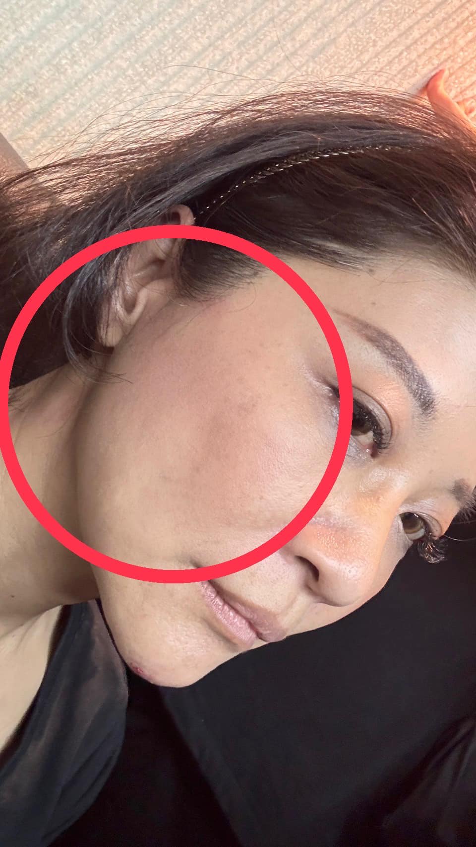 林楚茵被王鴻薇連續打好幾個巴掌。（翻攝自立法委員 林楚茵臉書）