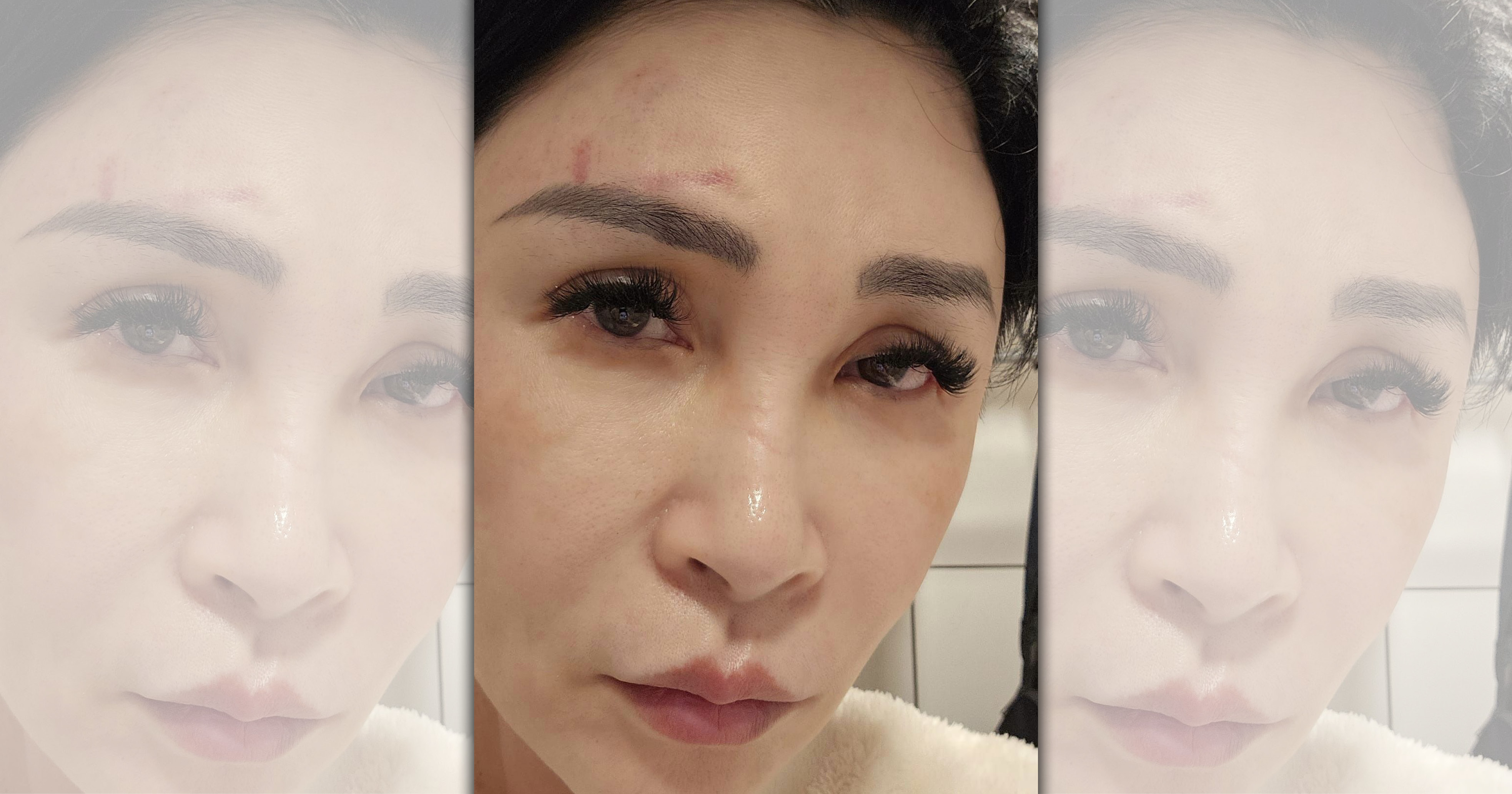 王瑞玲在臉書po文，跨年夜當天突然昏倒在廁所，還撞上洗手台。（翻攝自王瑞玲臉書）