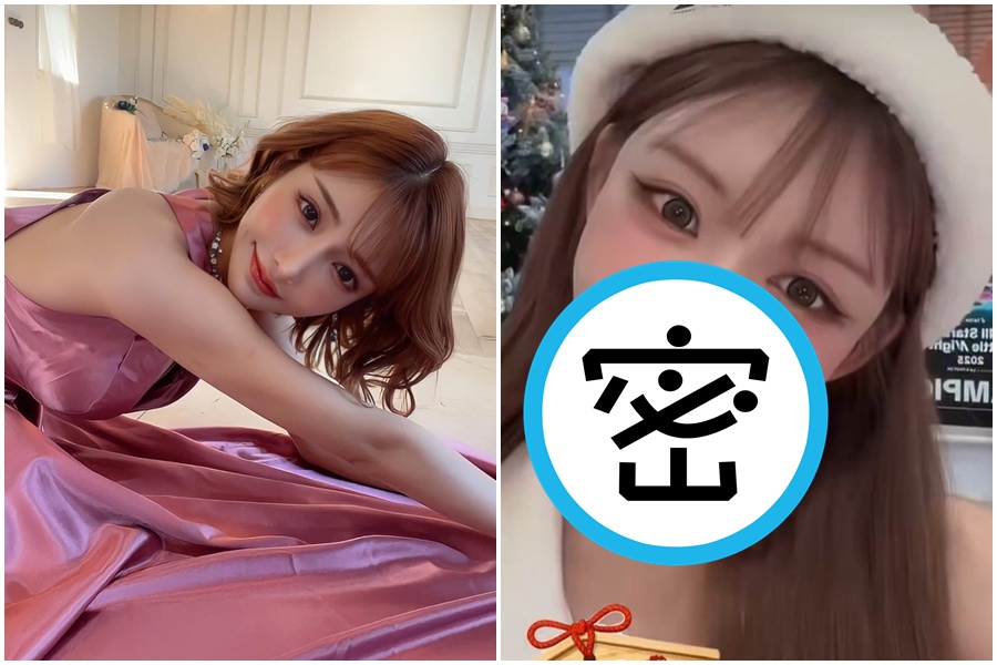 明日花綺羅缺牙引起討論。（翻攝自X@asukakiraran）