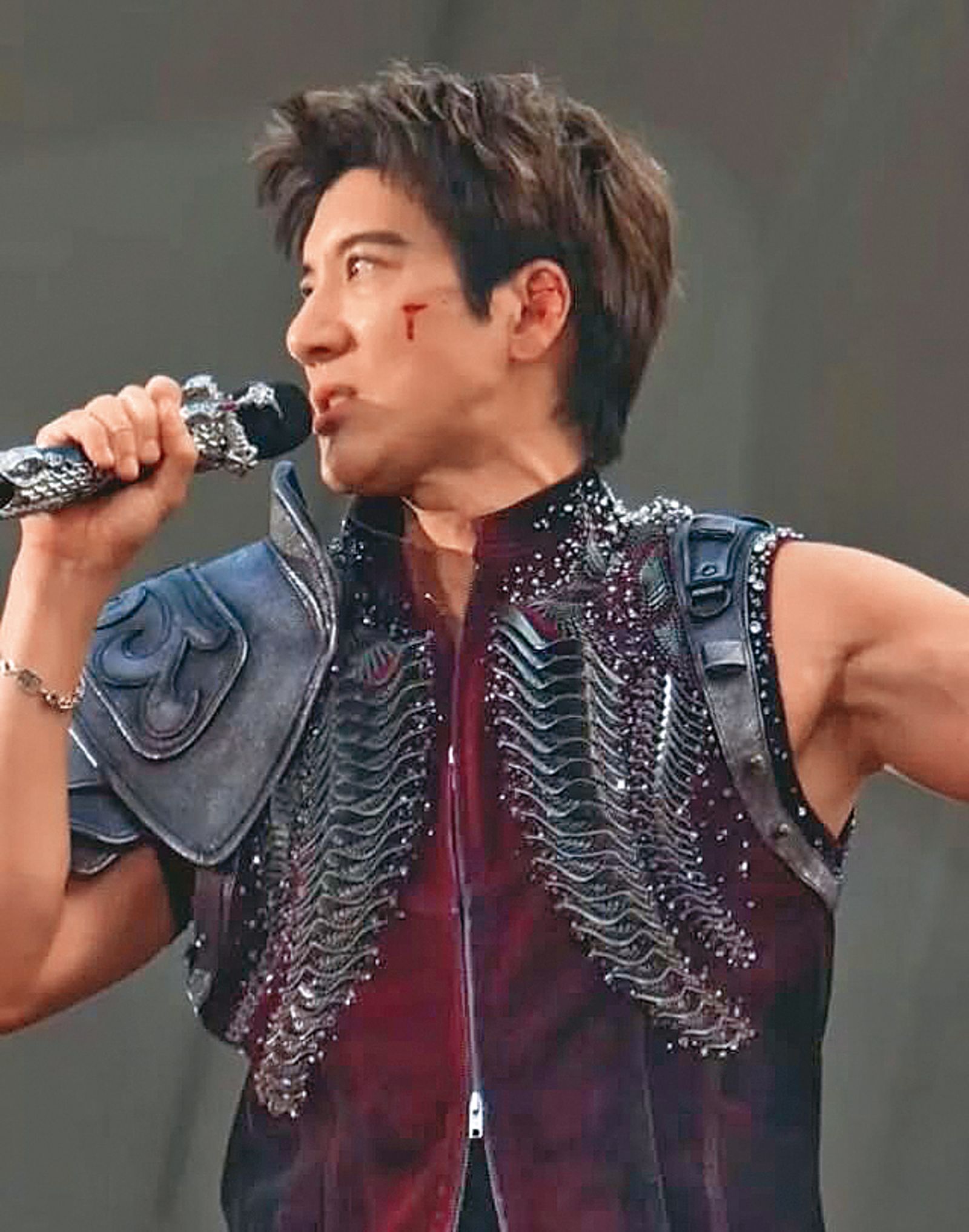 7月初王力宏在成都摔傷了臉頰跟耳朵，邊流血邊唱完3小時。（翻攝自王力宏臉書）