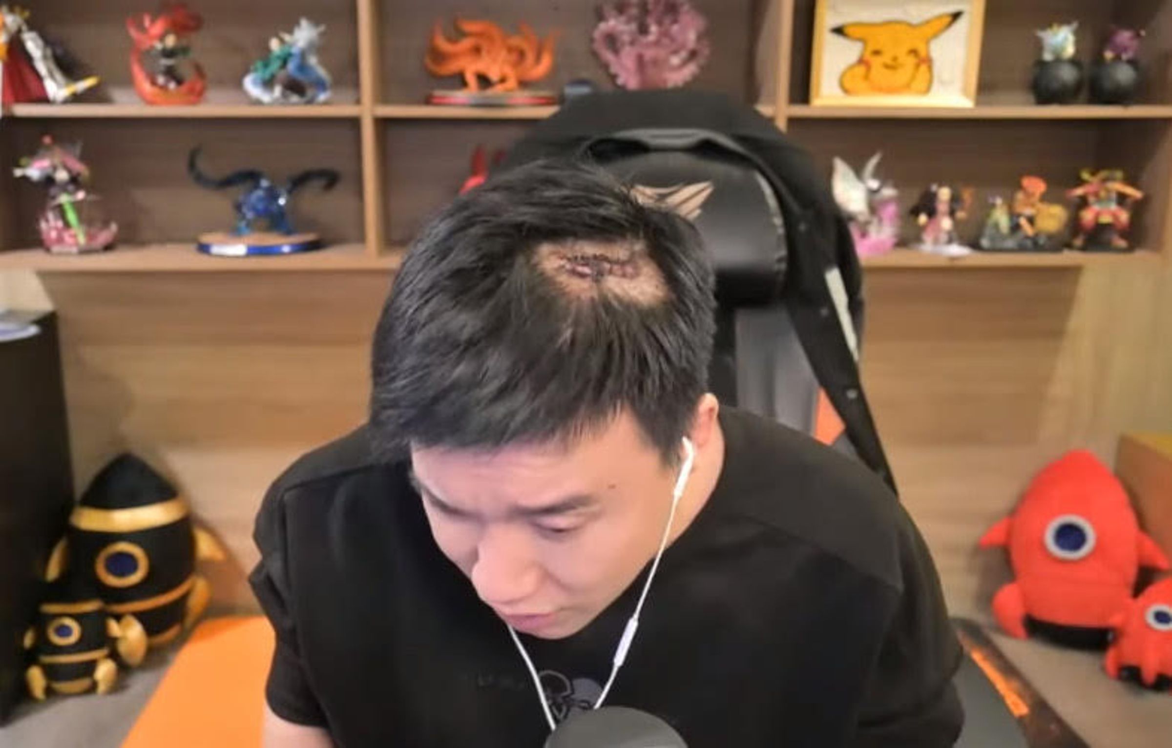 網紅Toyz直播時公開頭上傷口,警告將點名發聲支持超哥的網紅。(翻攝YT頻道Toyz)