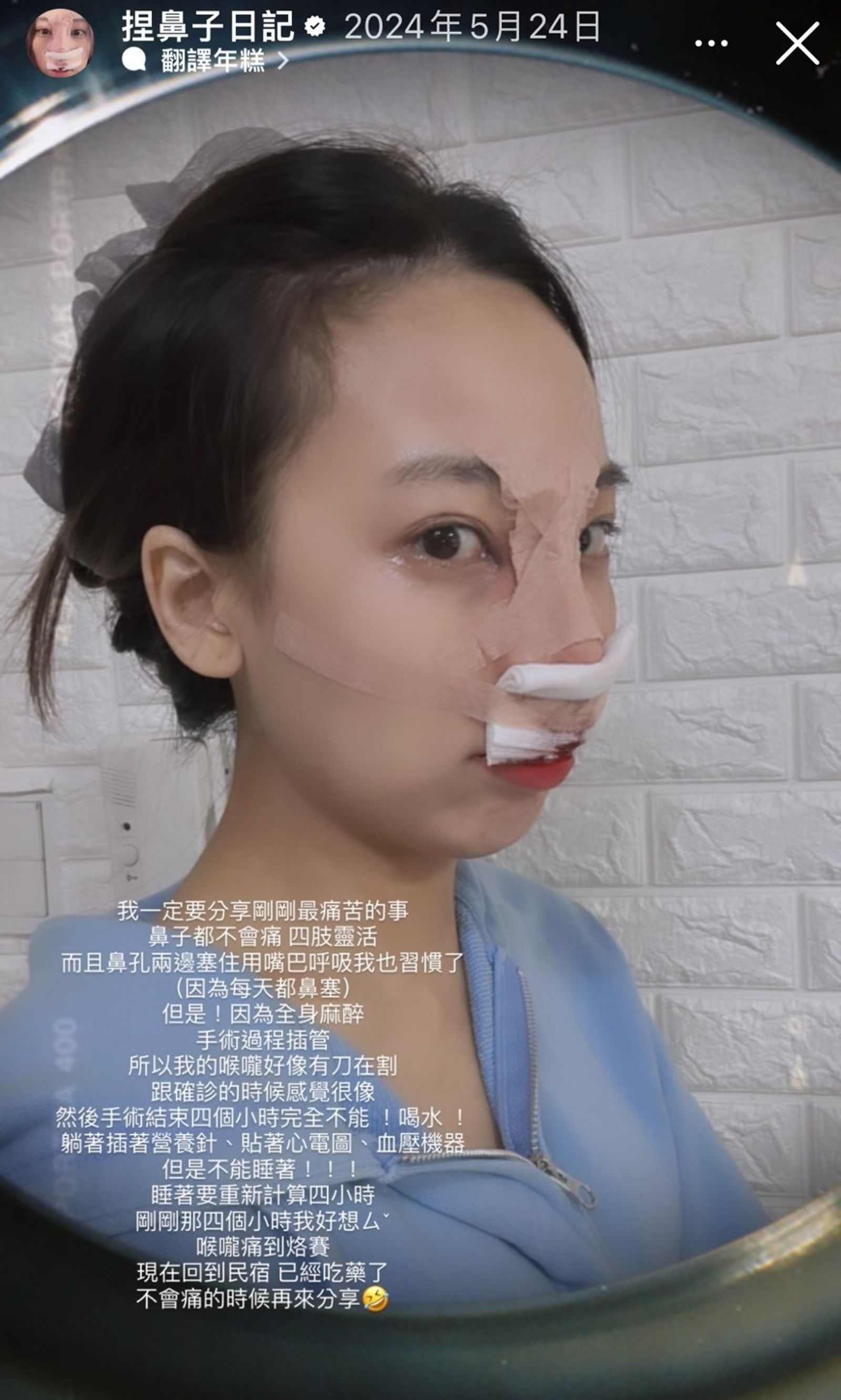陳瑾緗與韓國醫美診所合作,要在IG分享整個變身過程。(翻拍自Allyson IG)