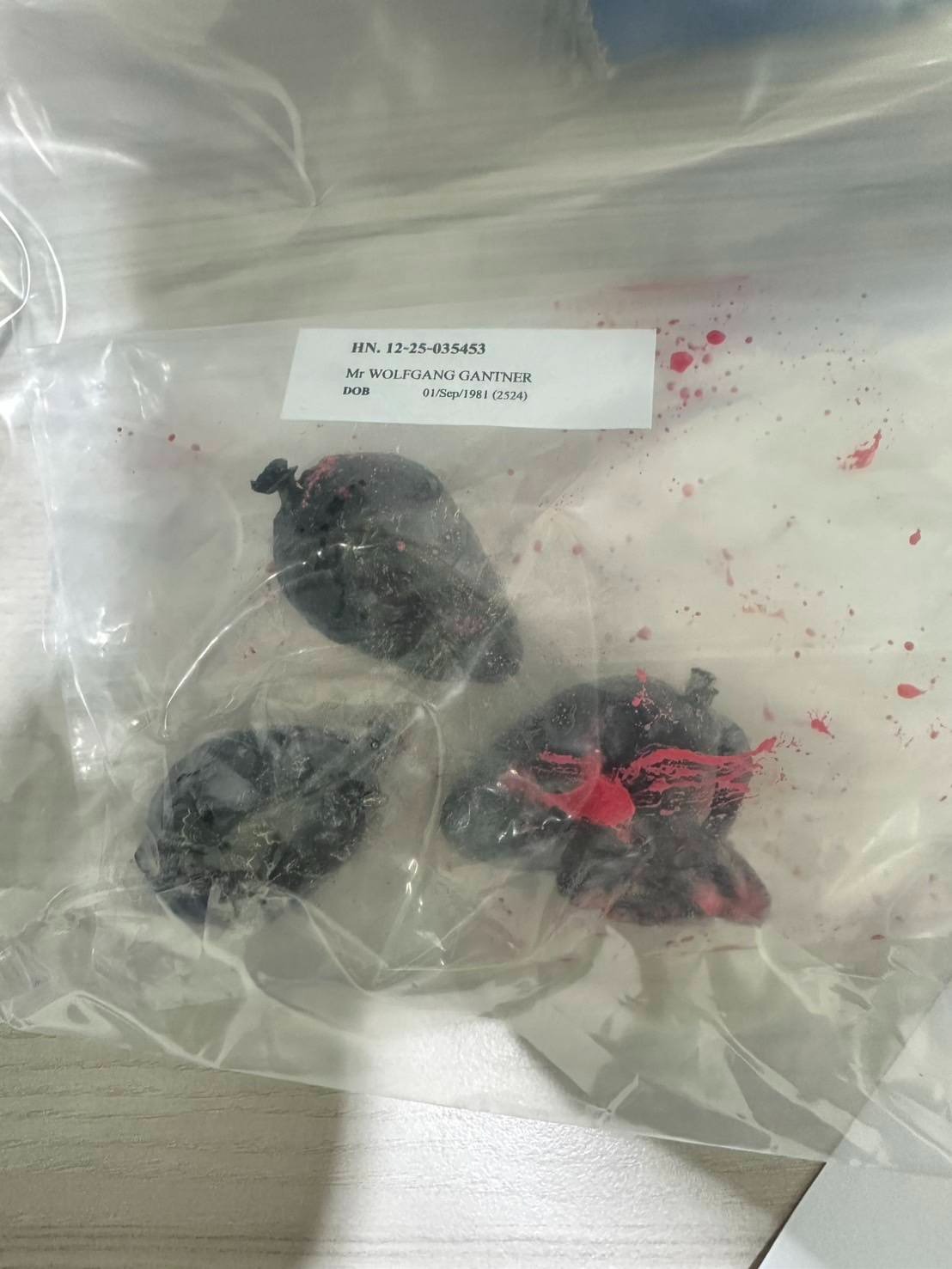 43歲奧地利籍男子甘特納體內取出3包毒品，其中1包已經破裂。（翻攝自สถานีตำรวจนครบาลหัวหมาก FB）