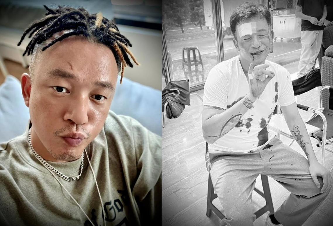 阿Ben拍戲意外受傷，強調未責怪任何人，感謝及時送醫與團隊照顧。（翻攝臉書）